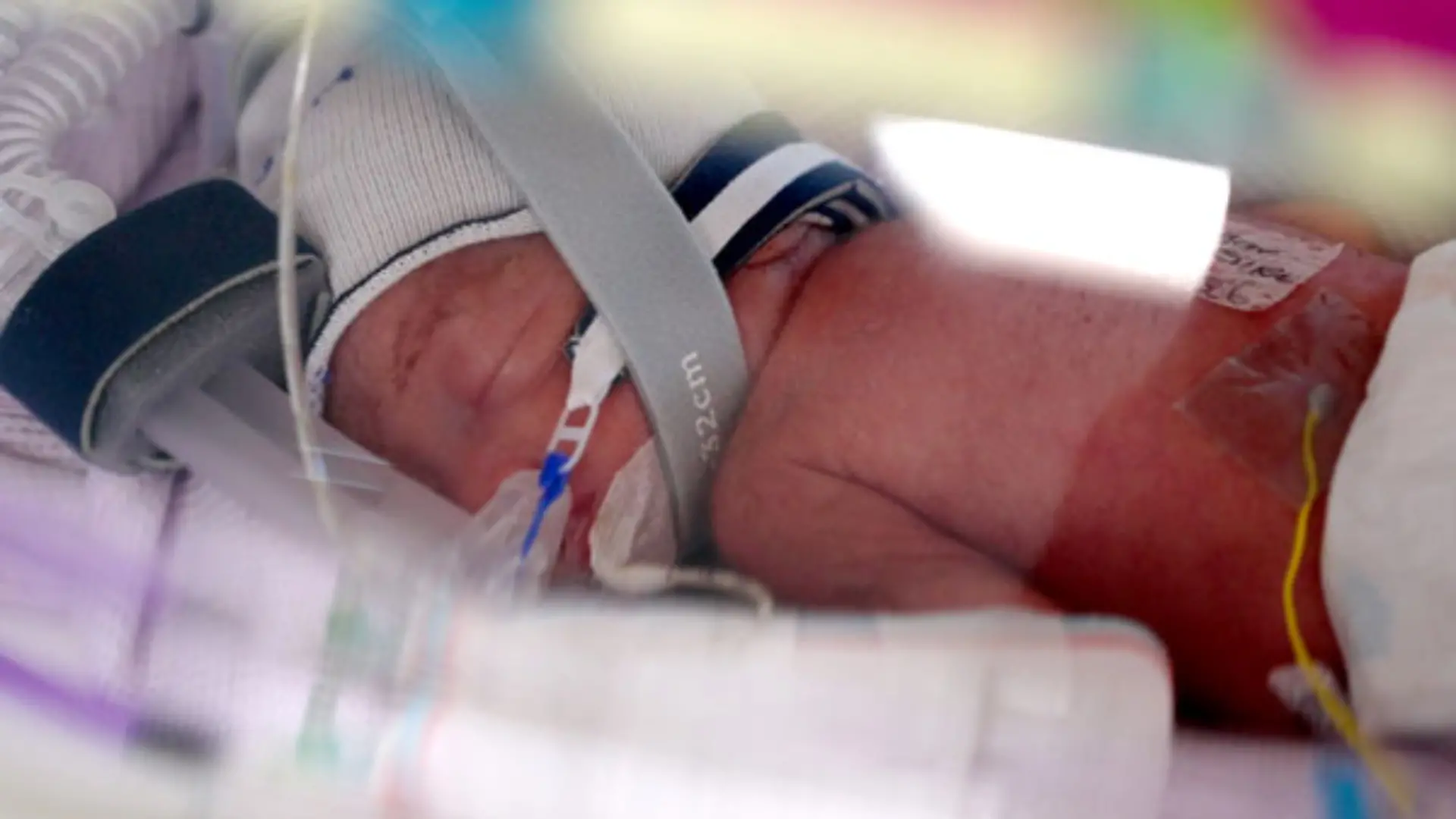 Die Säuglinge werden aktuell noch im Krankenhaus behandelt.
