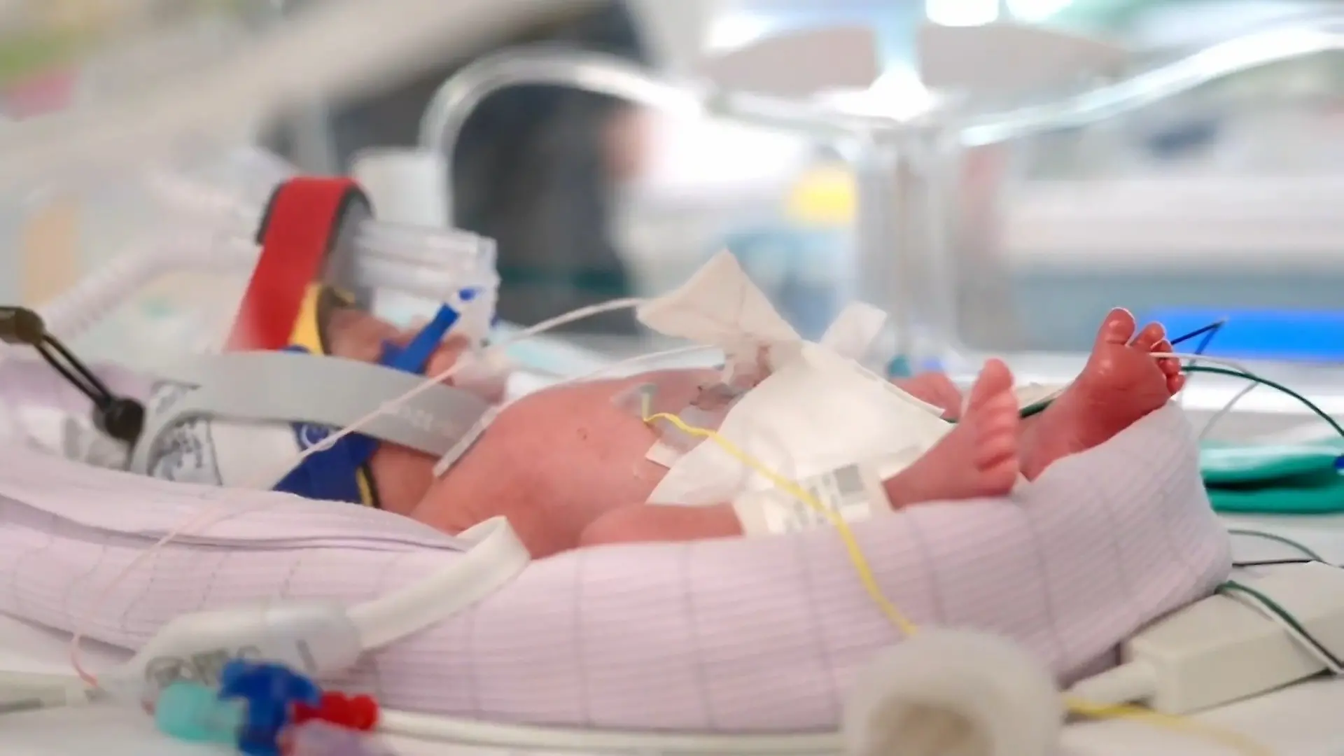 Weltweit erst einmal! DIESE Geburt ist seltener als ein Sechser im Lotto Vierfaches Babyglück