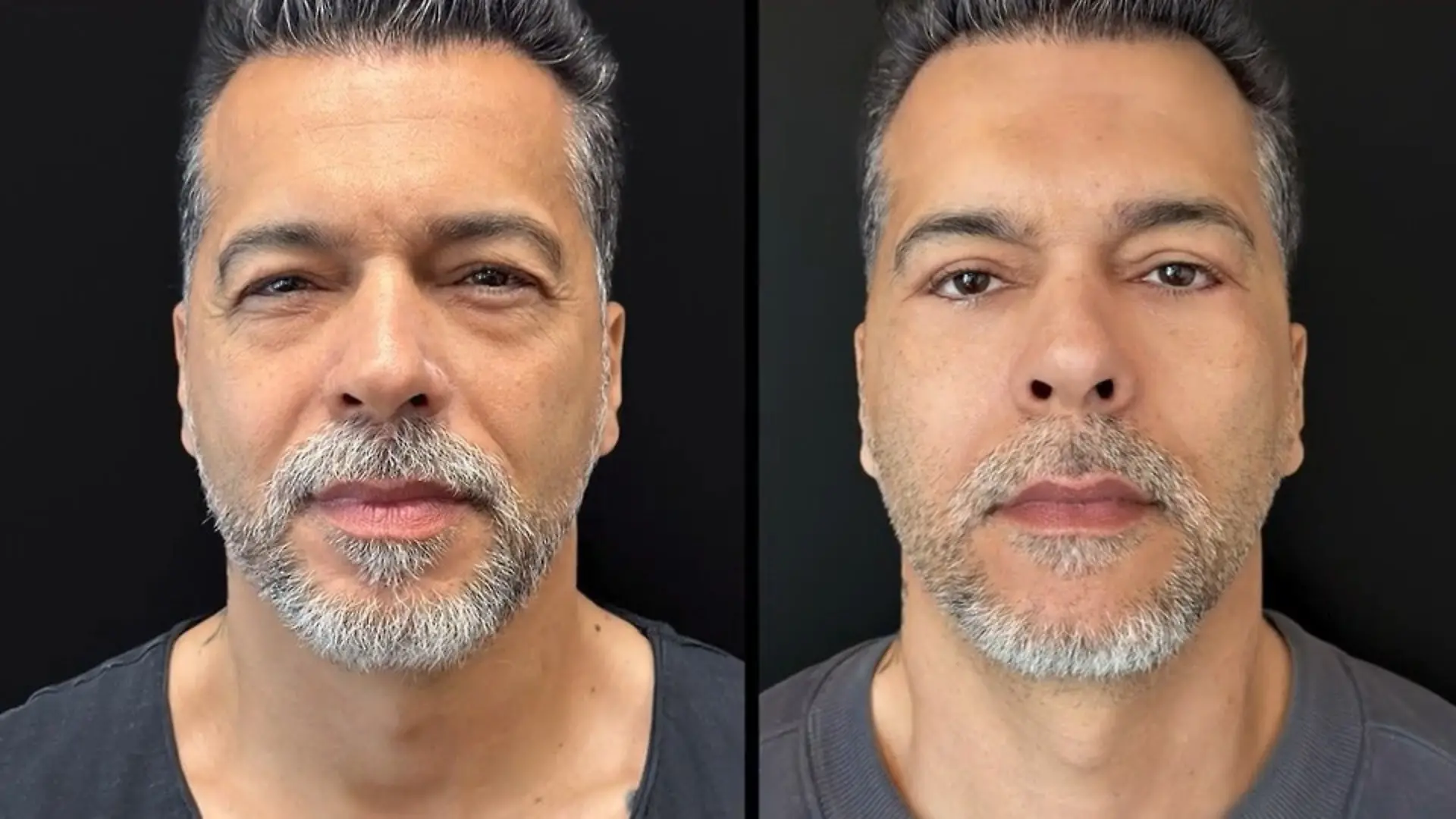 20 Jahre jünger: Aurelios Beauty-Schock Beauty-OP eskaliert