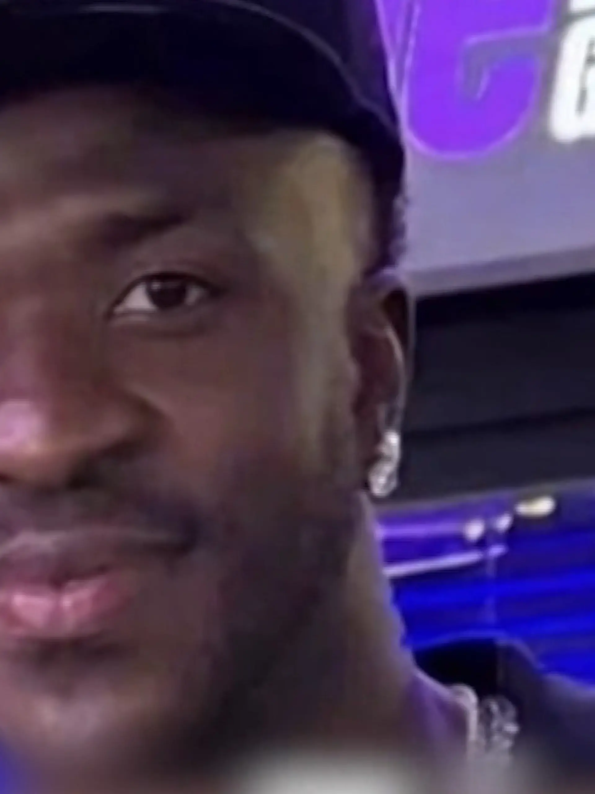 Bild zu: "Weltfußballer macht Beauty-Eingriff – und sieht plötzlich völlig verändert aus!"