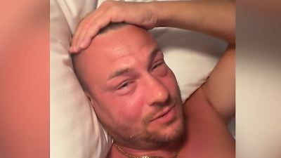 Bild von Kaum wiederzuerkennen! Gesicht von Reaity-Star Eric Sindermann komplett angeschwollen