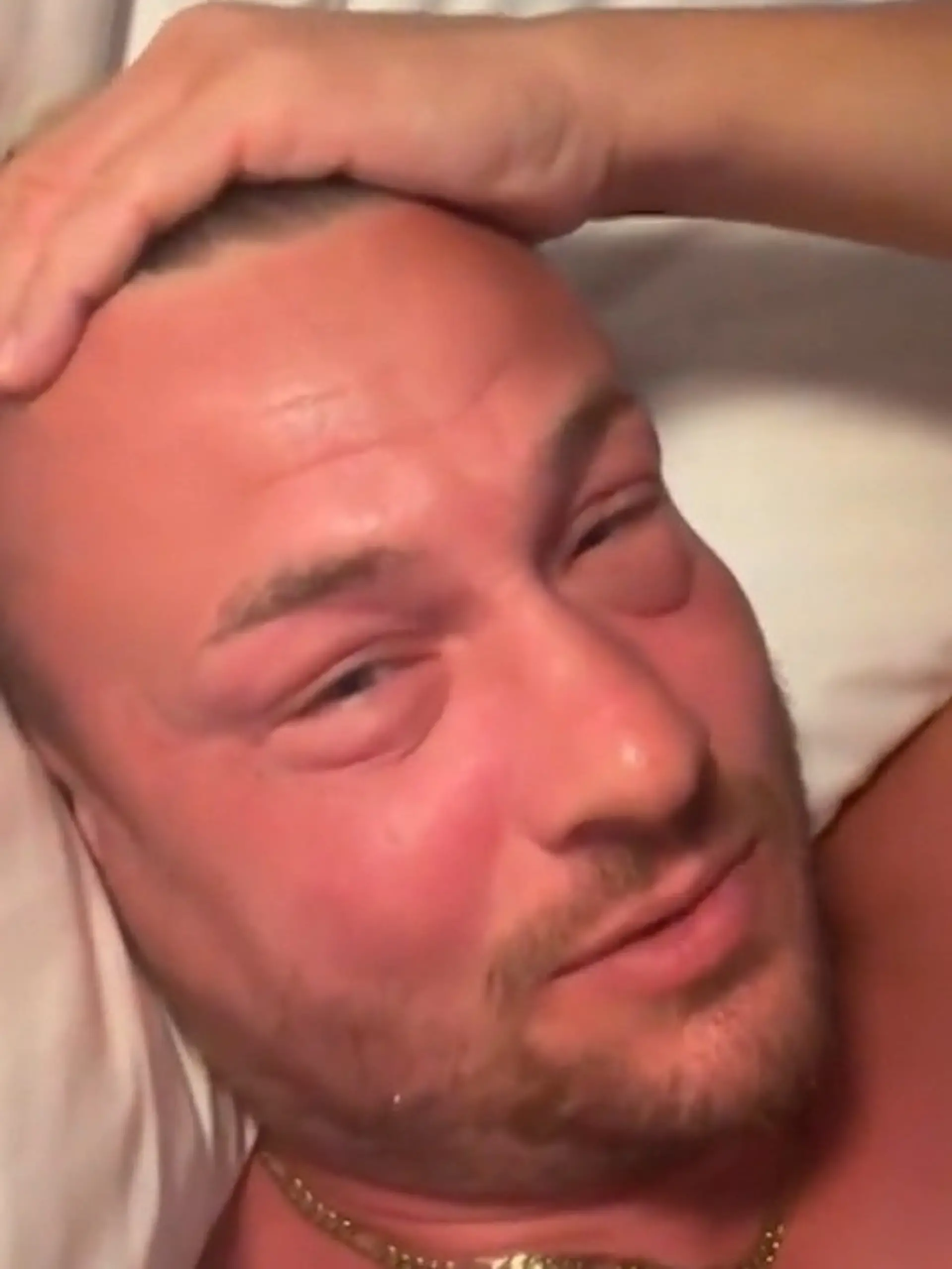 Bild zu: "Kaum wiederzuerkennen! Gesicht von Reaity-Star Eric Sindermann komplett angeschwollen"