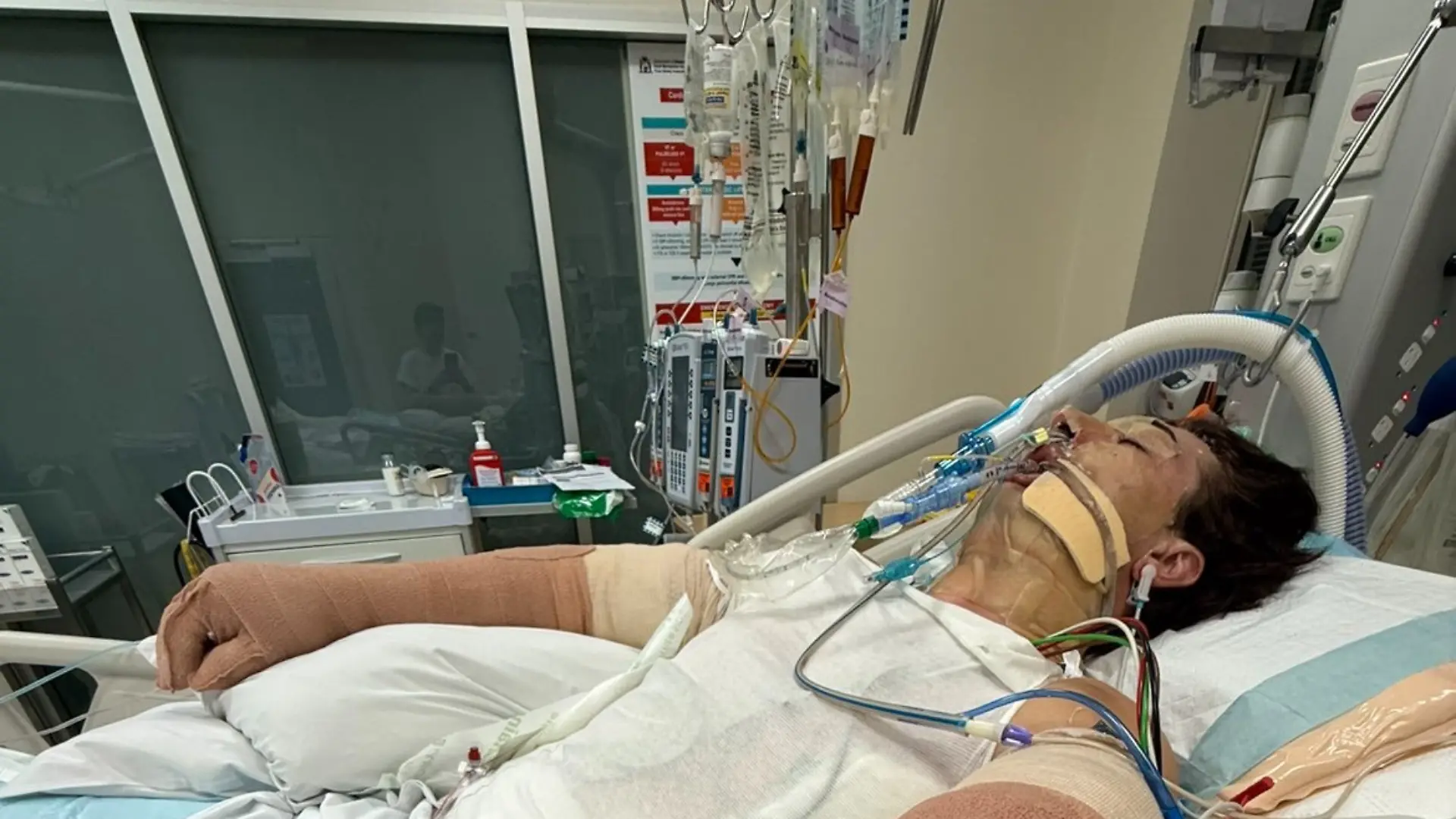 Seit der Explosion wird Lachie Perrem im Krankenhaus behandelt. Nach mehreren Operationen und Hauttransplantationen kämpft der Australier weiter um seine Genesung.
