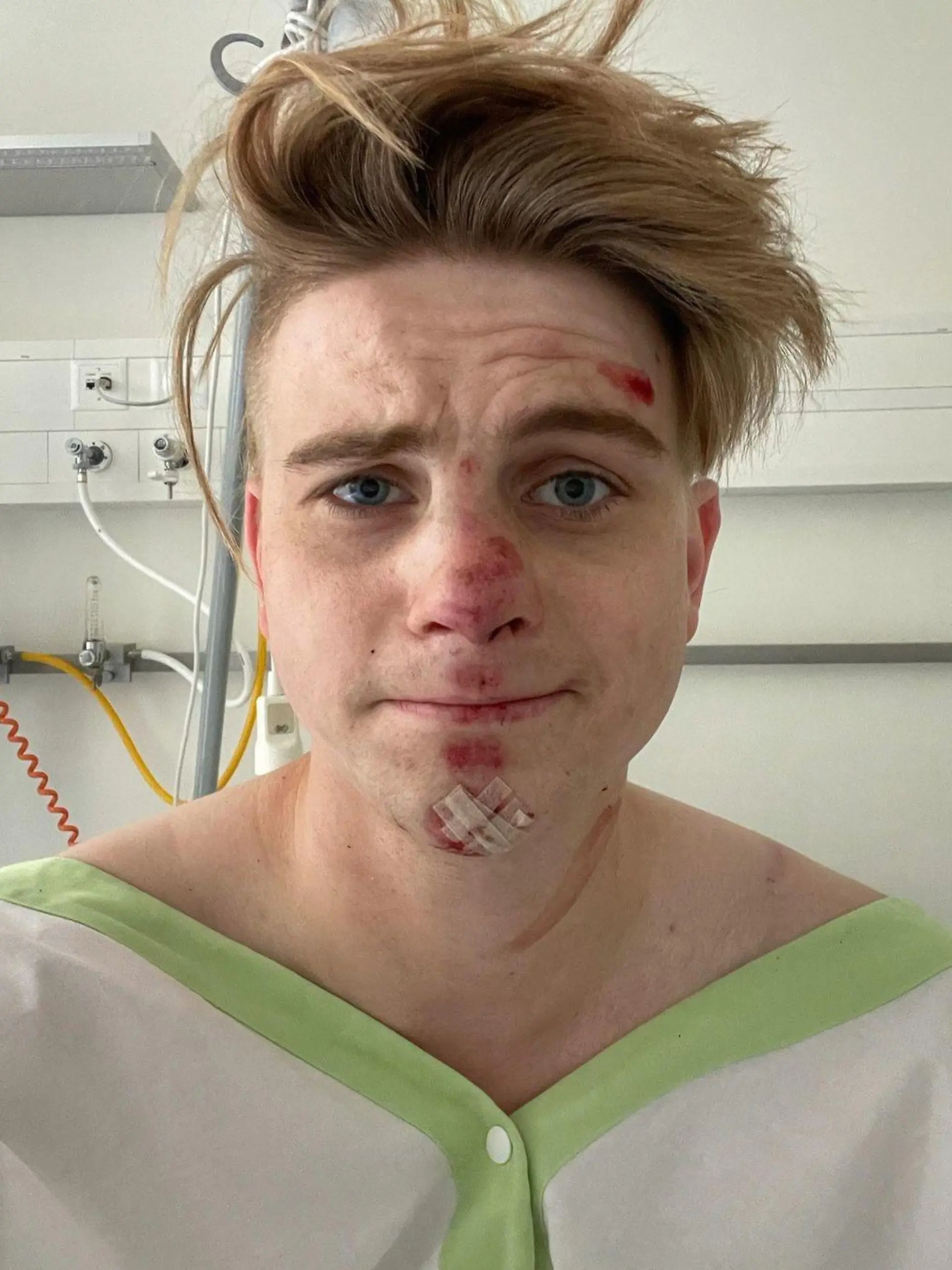 Schlagersänger Vincent Gross liegt nach seinem Fahrradunfall mit Schürfwunden und einer Gehirnerschütterung im Krankenhaus.