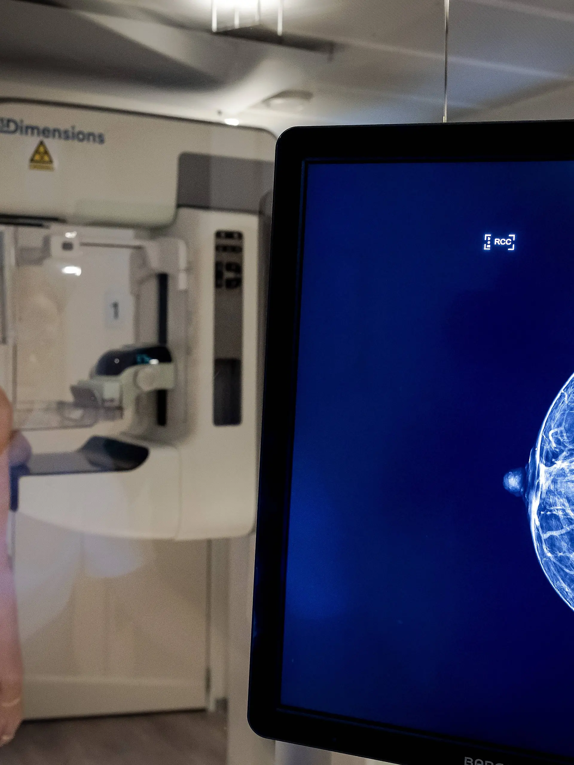 ILLUSTRATIVE - Mammographer with client during a breast cancer examination by an employee of Population Research Netherlands. ANP ROBIN VAN LONKHUIJSEN netherlands out - belgium out PUBLICATIONxINxGERxSUIxAUTxONLY Copyright: xx x485029312x originalFilename: 485029312.jpg