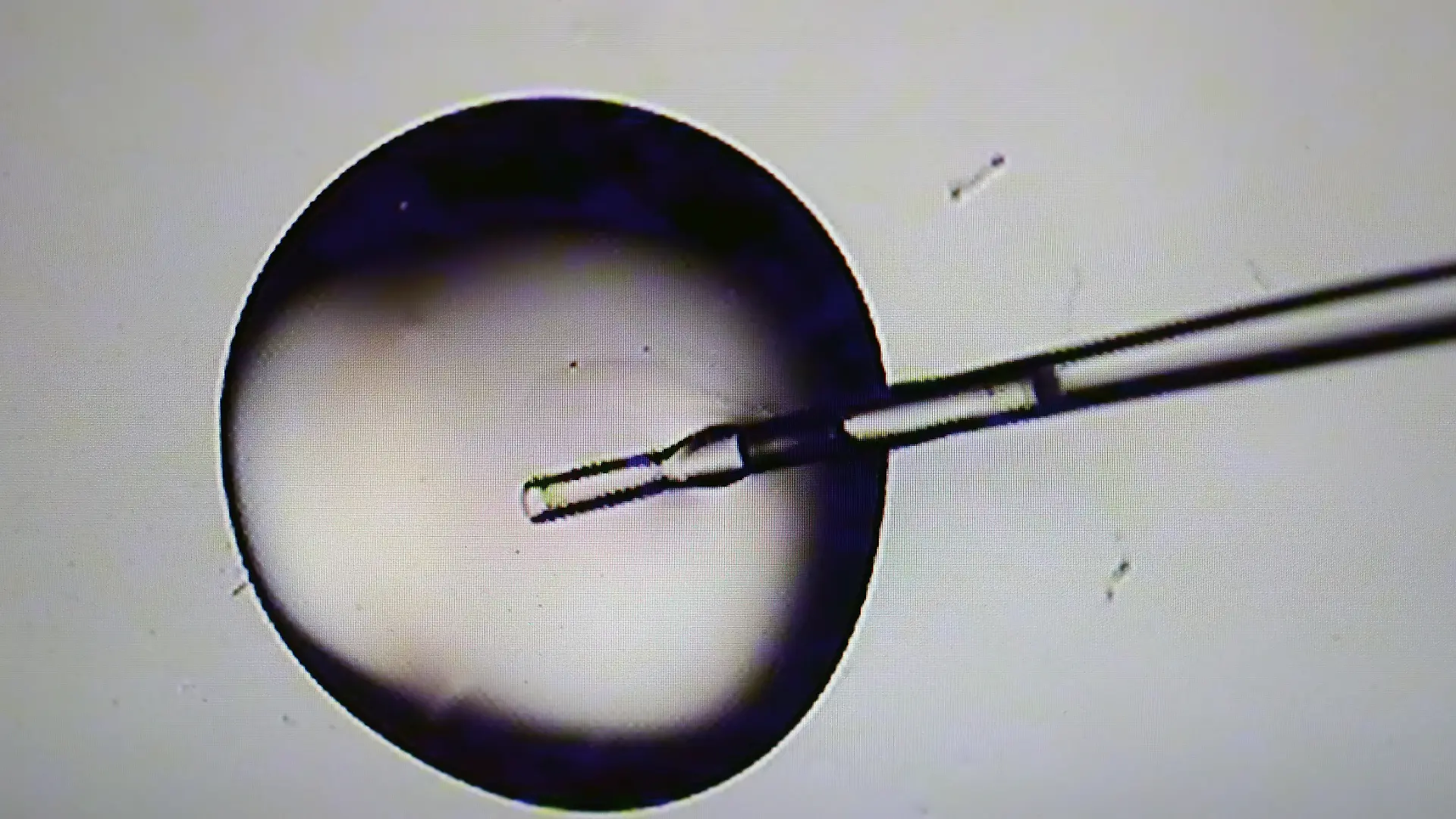 Boston, MA - March 15: A microscopic view of a cryo solution during embryo prep in the IVF lab at Brigham & Women's Hospital. (Photo by David L. Ryan/The Boston Globe via Getty Images)