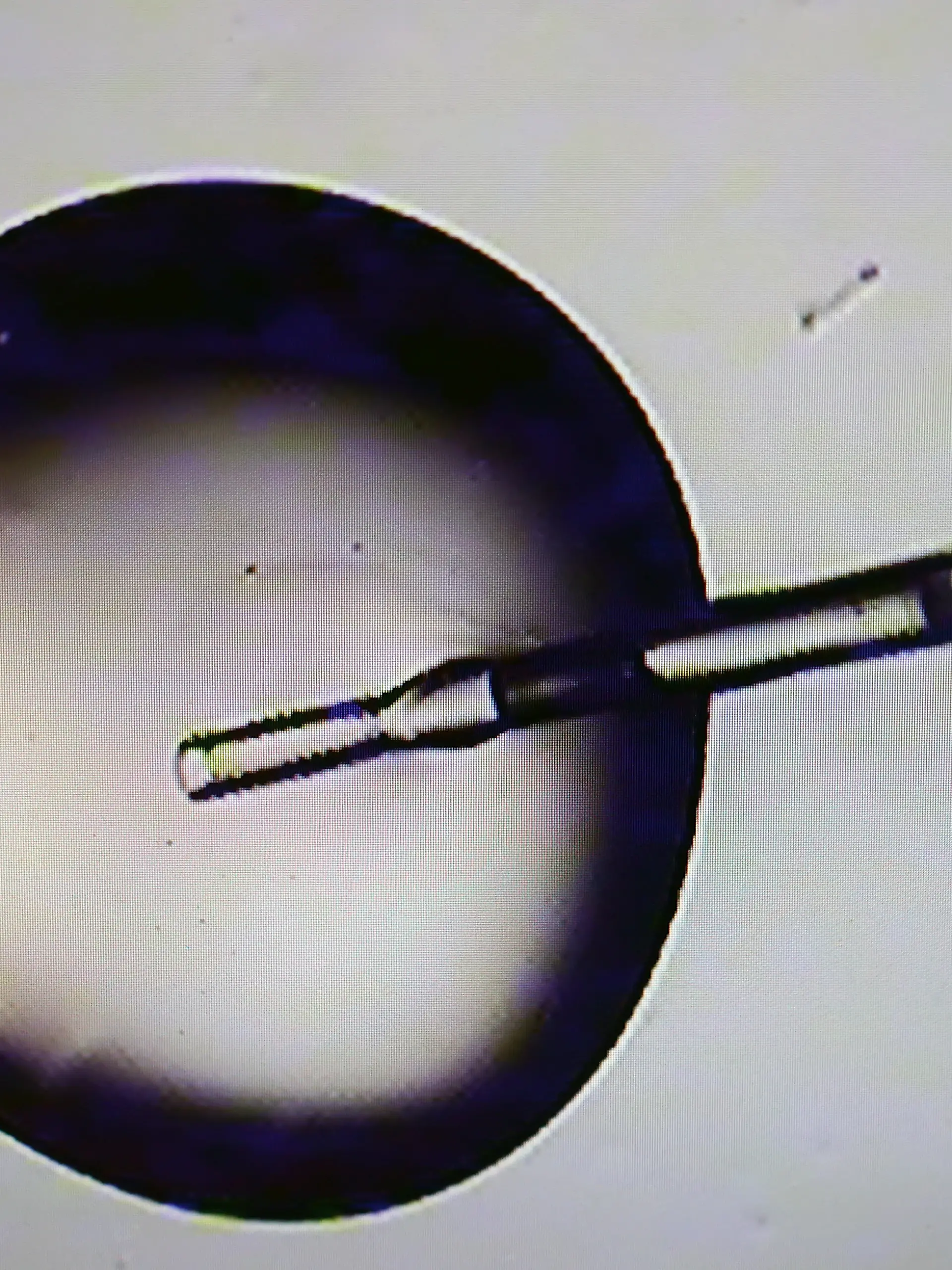 Boston, MA - March 15: A microscopic view of a cryo solution during embryo prep in the IVF lab at Brigham & Women's Hospital. (Photo by David L. Ryan/The Boston Globe via Getty Images)