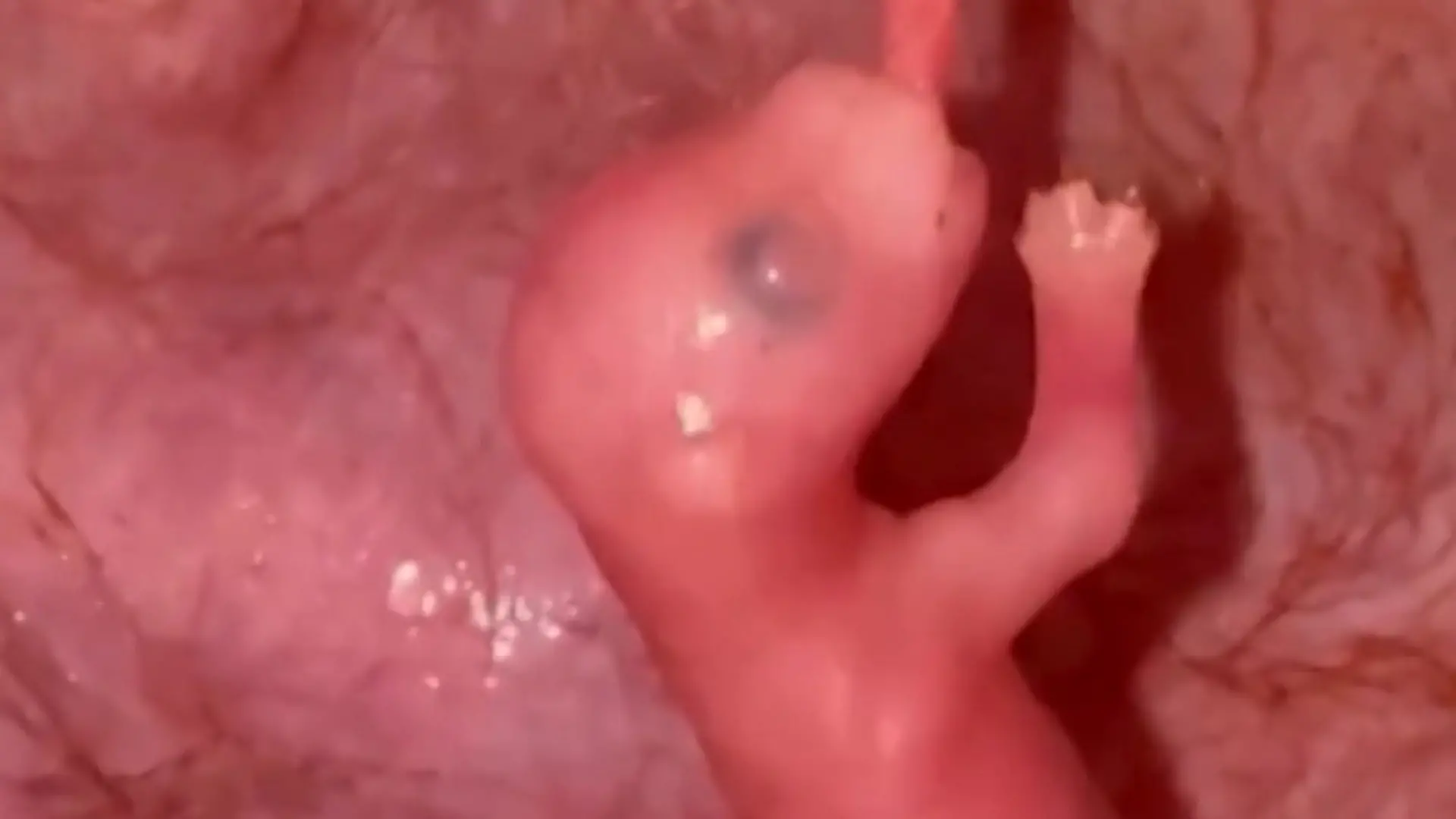 Einzigartige Aufnahmen! Kamera zeigt Känguru-Baby IM Beutel Das habt ihr noch nie gesehen