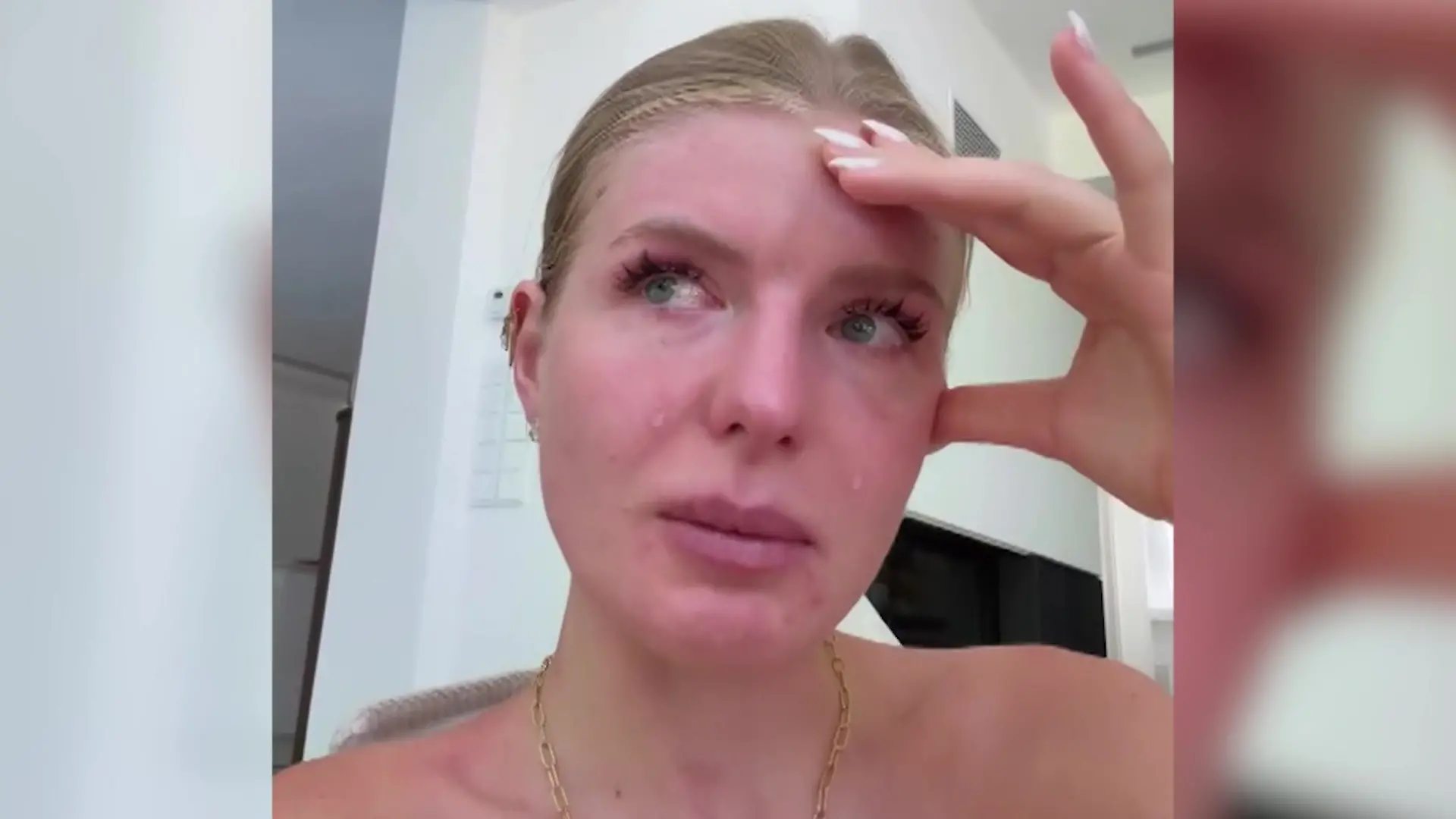 Bild zu: "„Das tut so weh“ – Trennungsschmerz bei Ex-„Sommerhaus"-Star!"