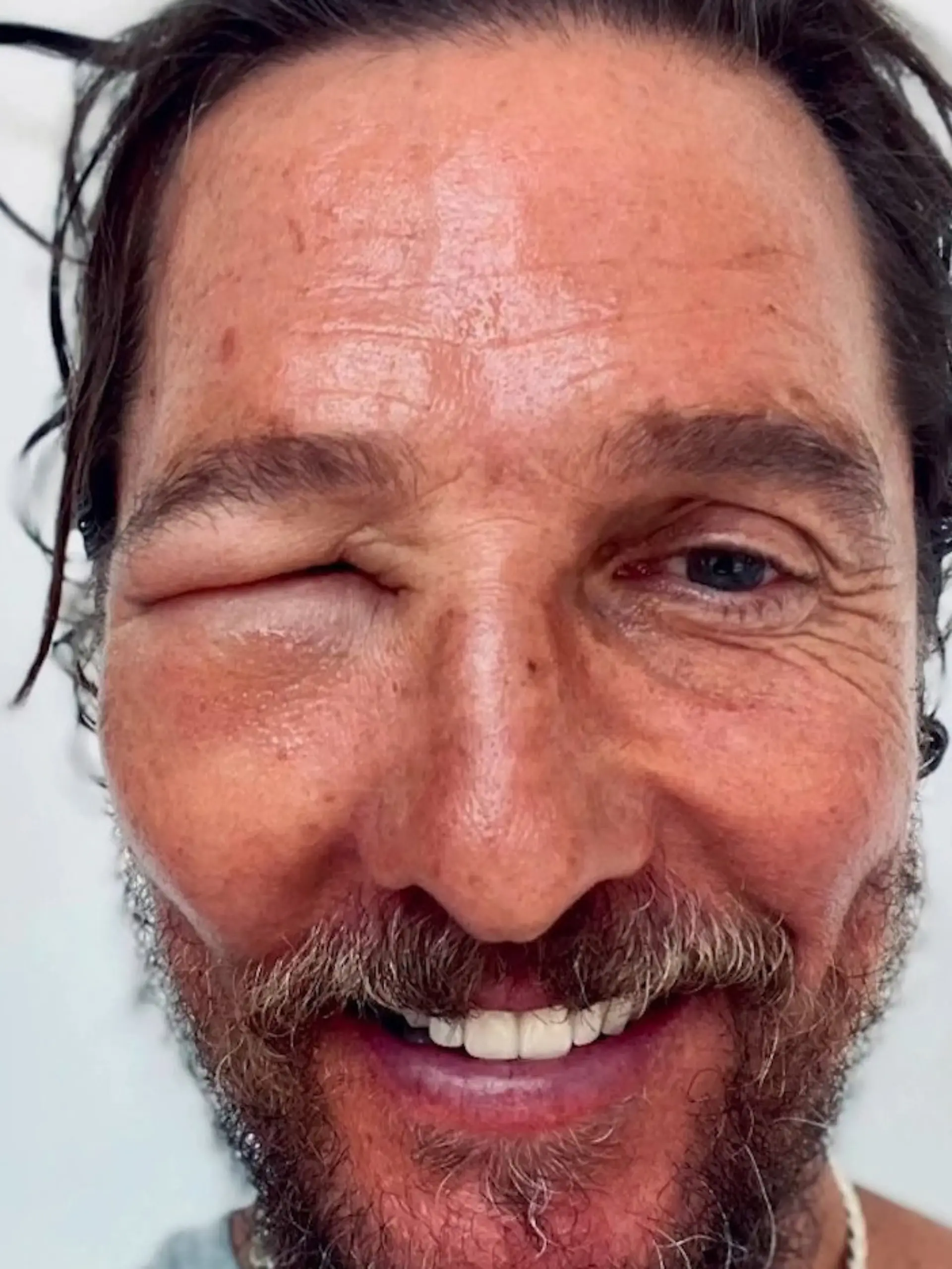 Bild zu: "Tier-Attacke auf Hollywood-Star! Gesicht von Schauspieler total entstellt"