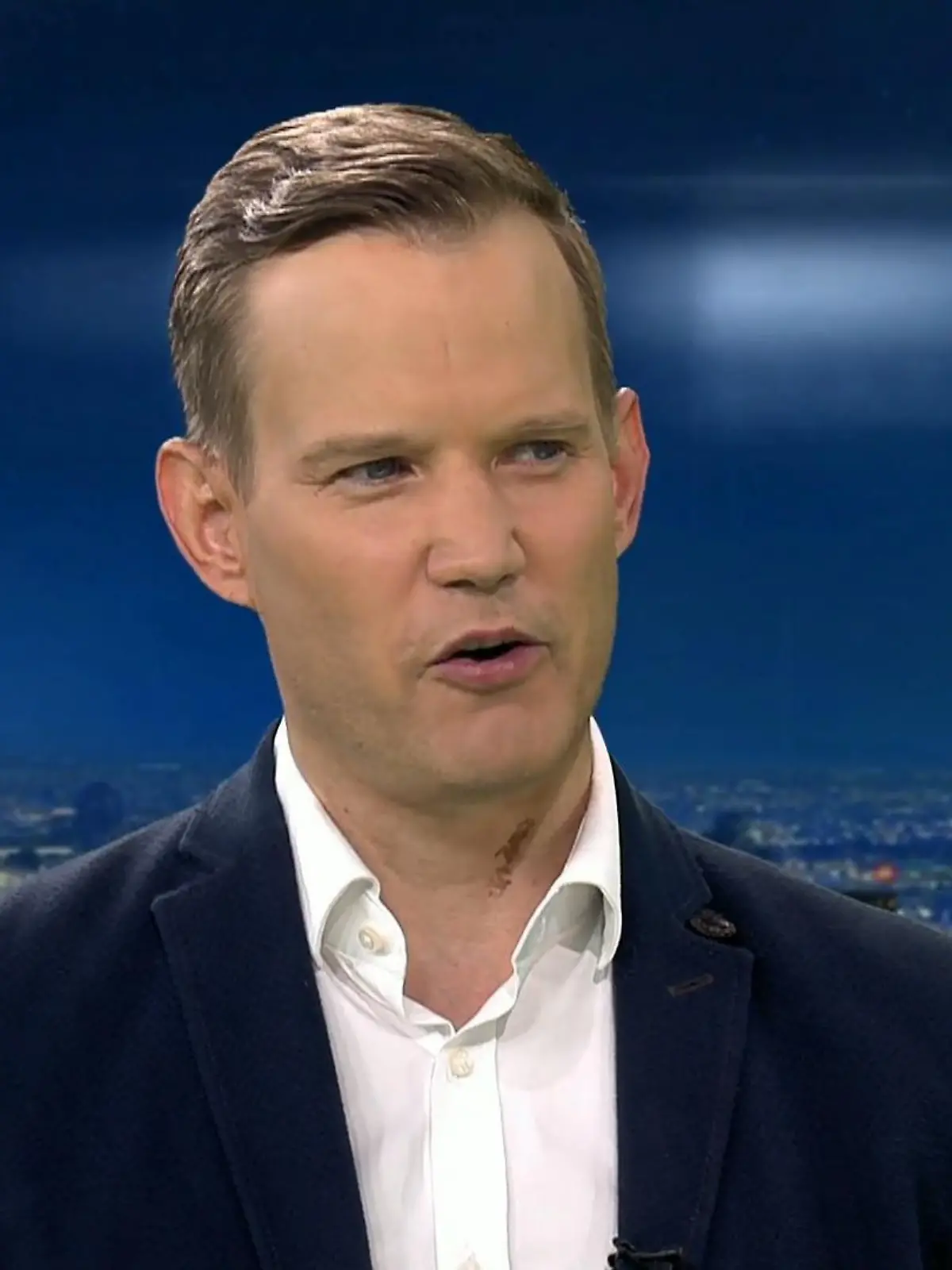 Bild zu: ""Hab keine Sorge vor Reiserückkehrern""