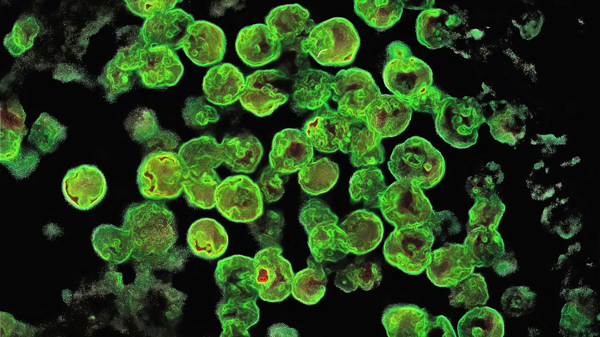 Ein stark vergrößertes Bild der Amöbe „Naegleria fowleri”.