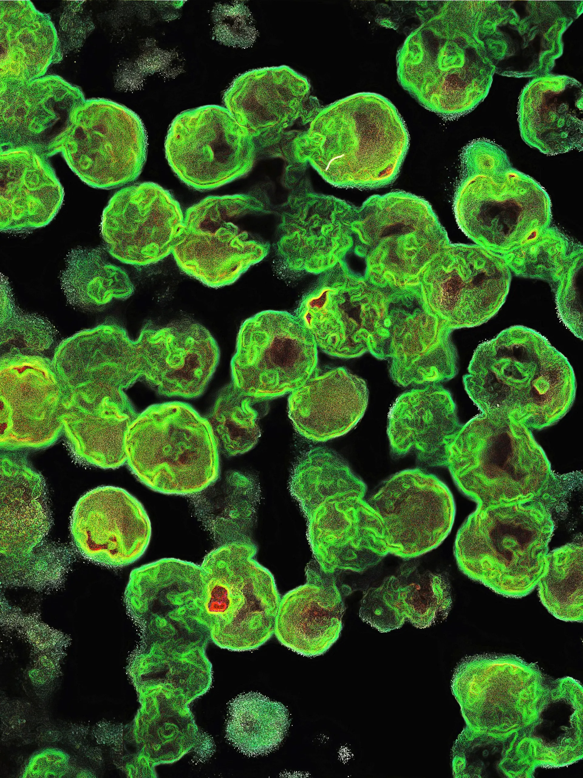 Ein stark vergrößertes Bild der Amöbe „Naegleria fowleri”.