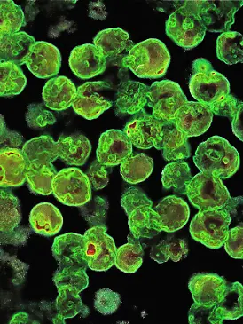 Ein stark vergrößertes Bild der Amöbe „Naegleria fowleri”.