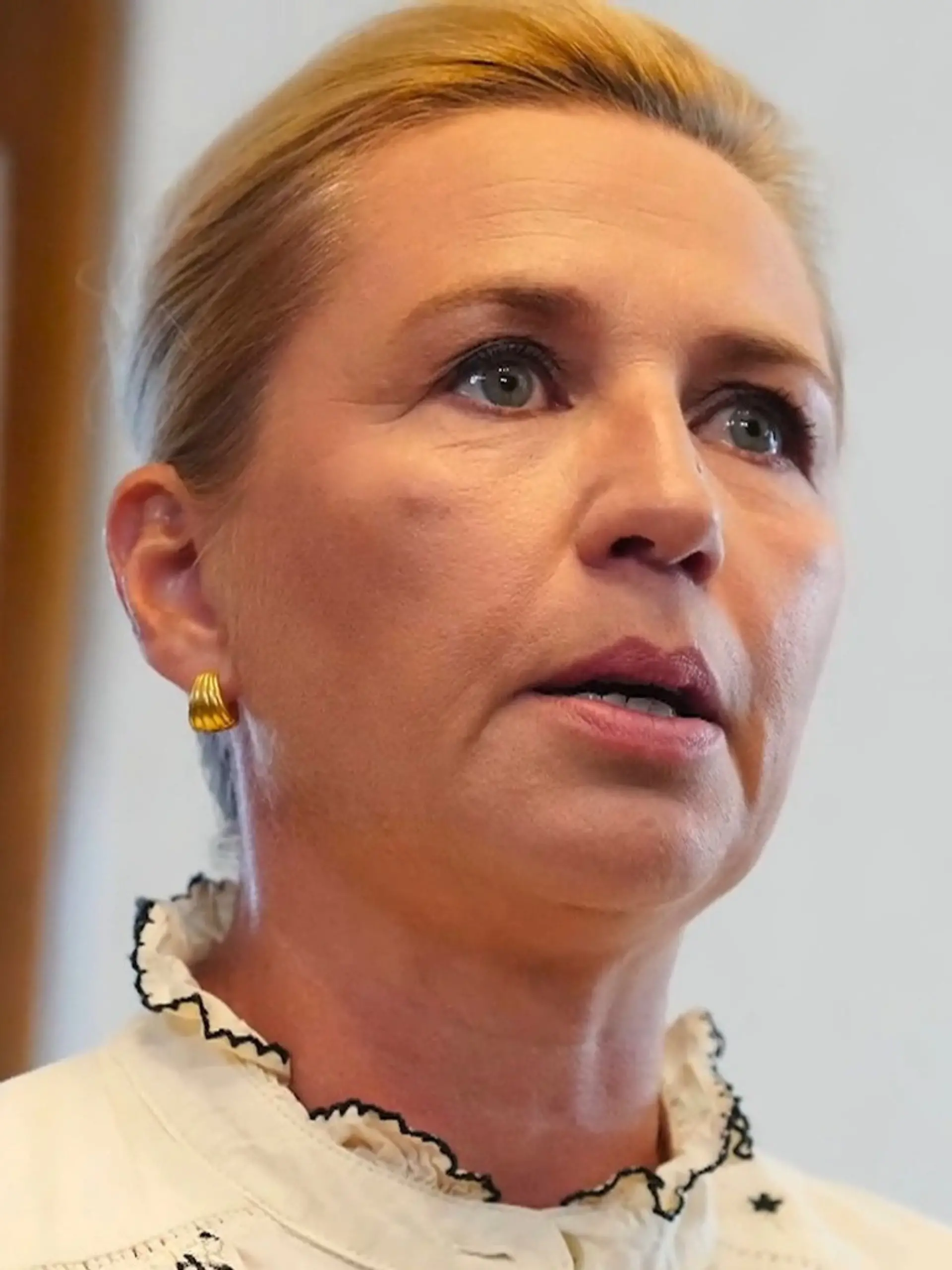 Bild zu: "Schönheitschirurg macht Regierungschefin ungefragt OP-Angebot – wegen dieses Körperteils!"