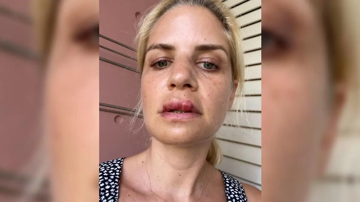 Schauspielerin Susan Sideropoulos hatte einen schwerer Radunfall.