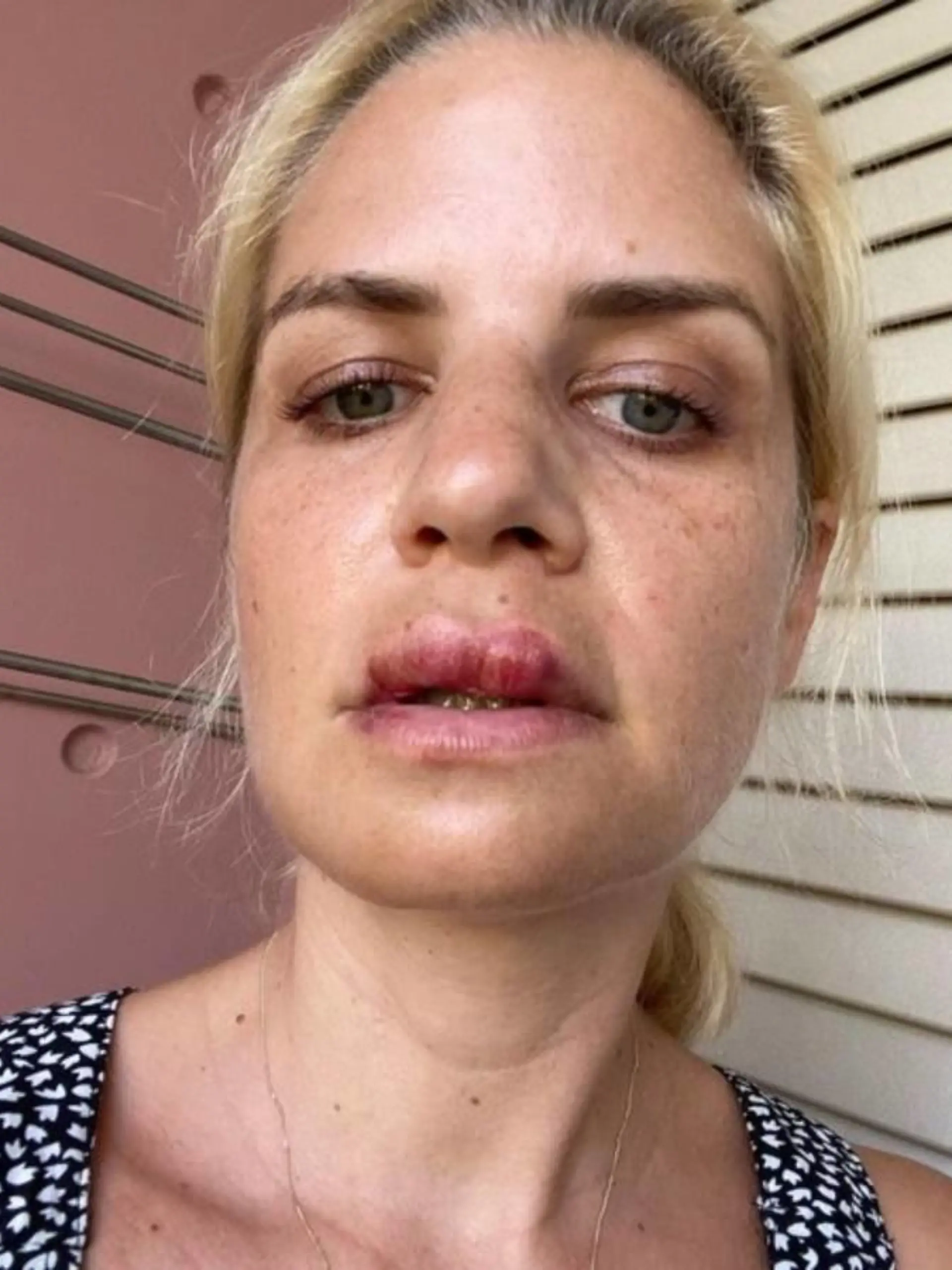 Schauspielerin Susan Sideropoulos hatte einen schwerer Radunfall.
