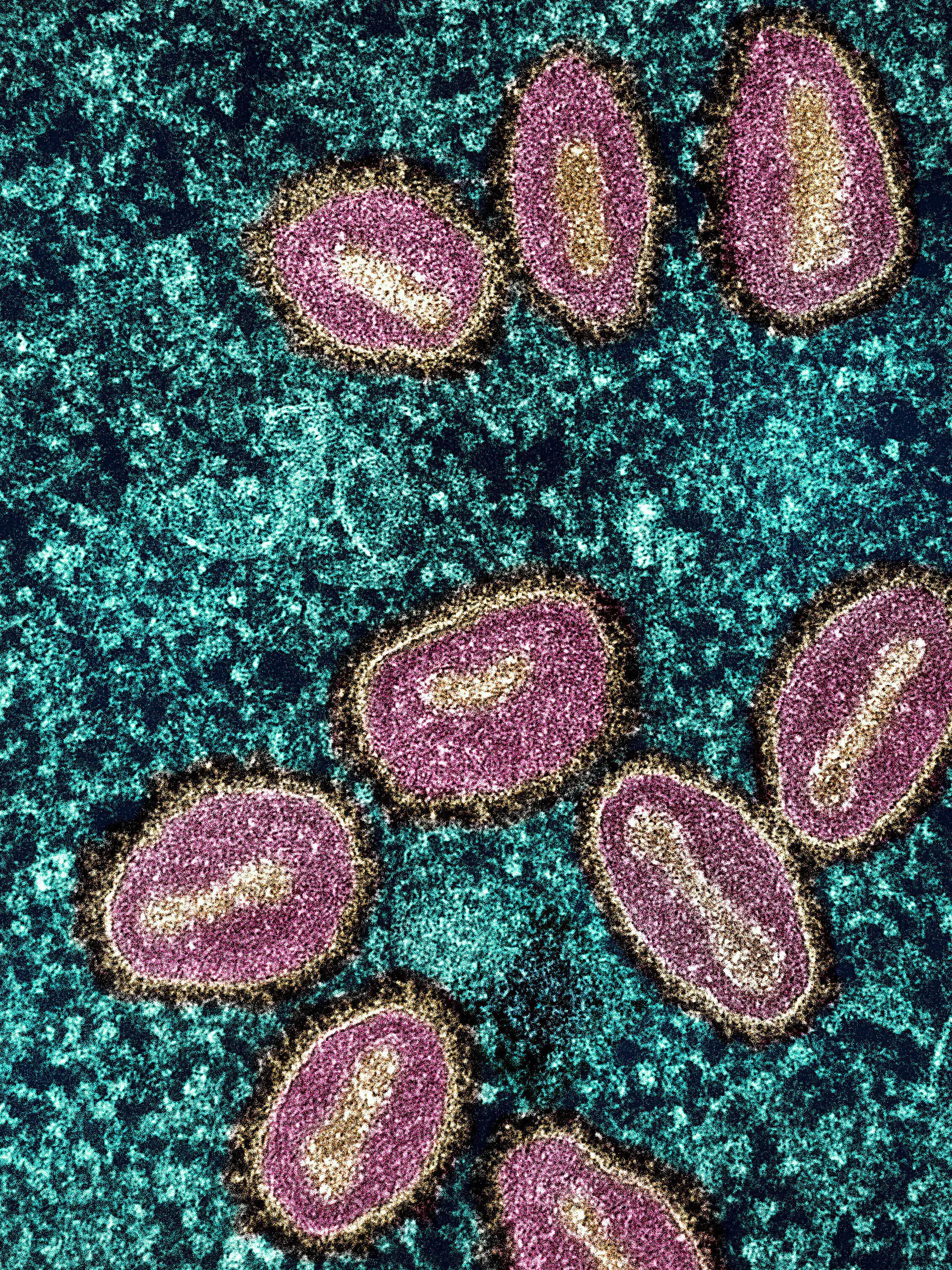 Colorized transmission electron micrograph of mpox virus particles (pink/gold) found within an infected cell (teal).