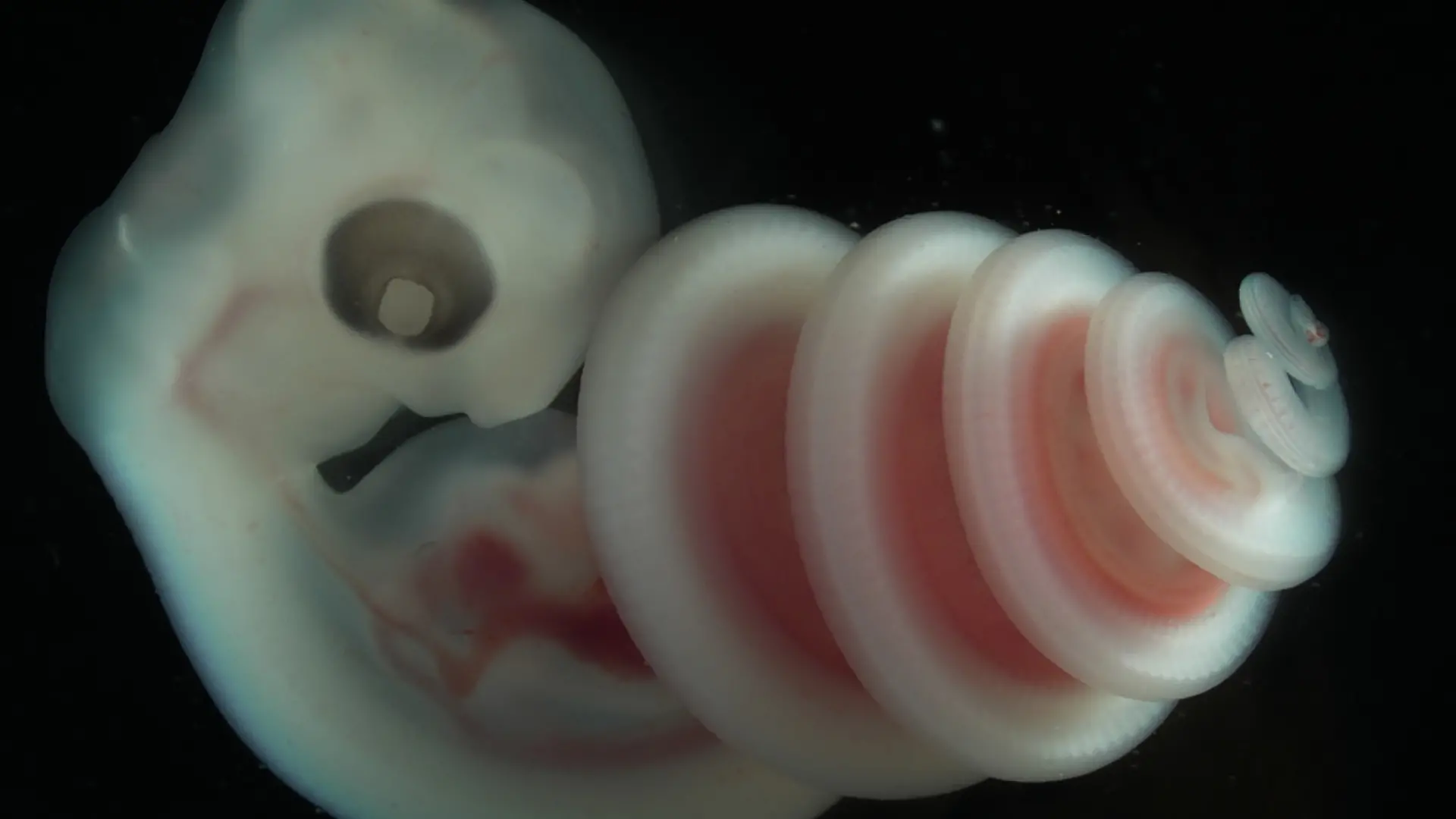 HANDOUT - Embryo of a Cape house snake (Boaedon capensis), one of the more than 900 specimens that were part of the study on snake coiling.
Credit: Raul Diaz, California State University Los Angeles
ACHTUNG: Frei nur zur redaktionellen Verwendung im Zusammenhang mit der Berichterstattung über die Studie bei Nennung des Credits. Foto: Raul Diaz, California State University Los Angeles