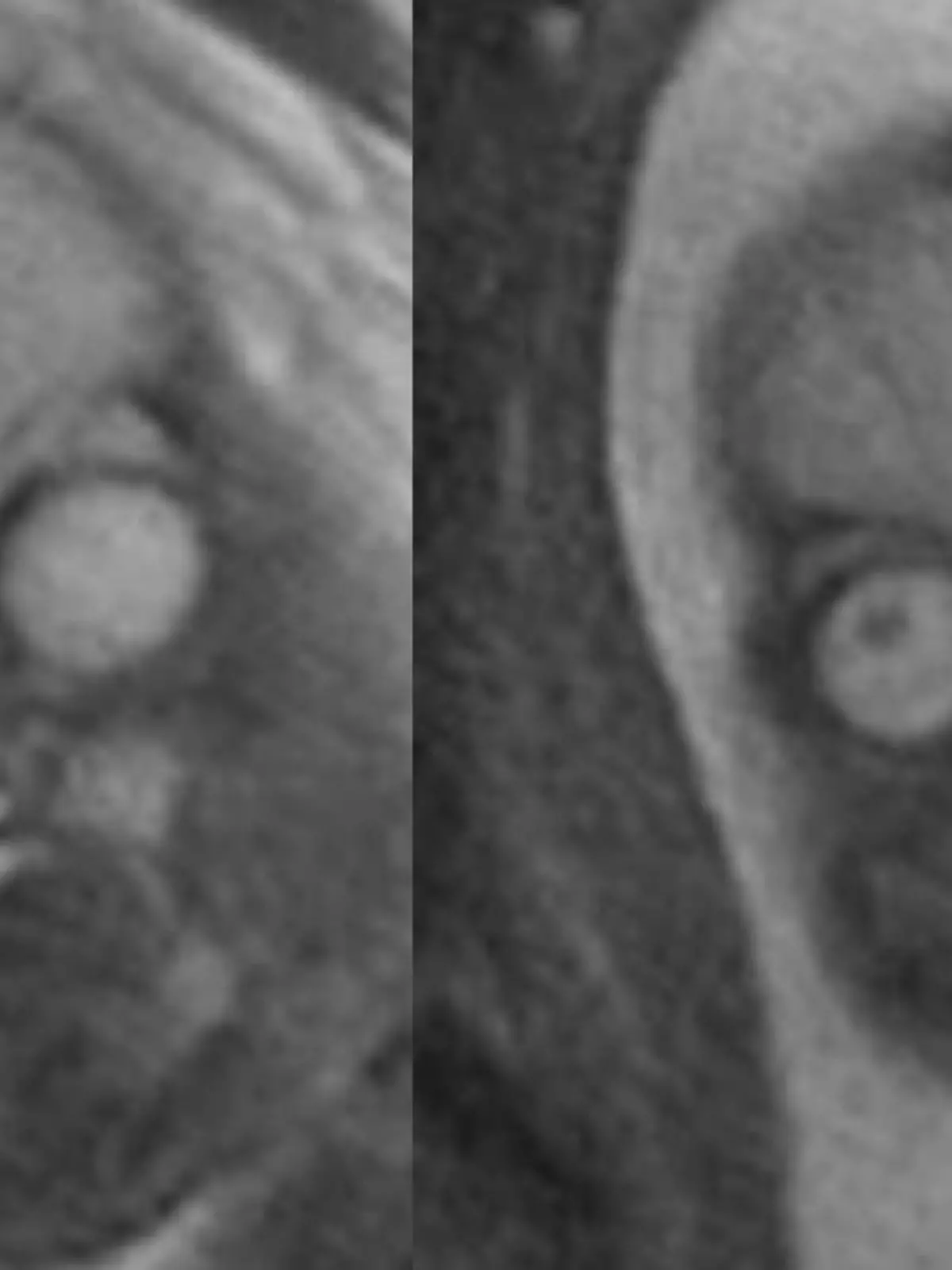 Bild zu: "So gruselig sehen Babys im Bauch aus"