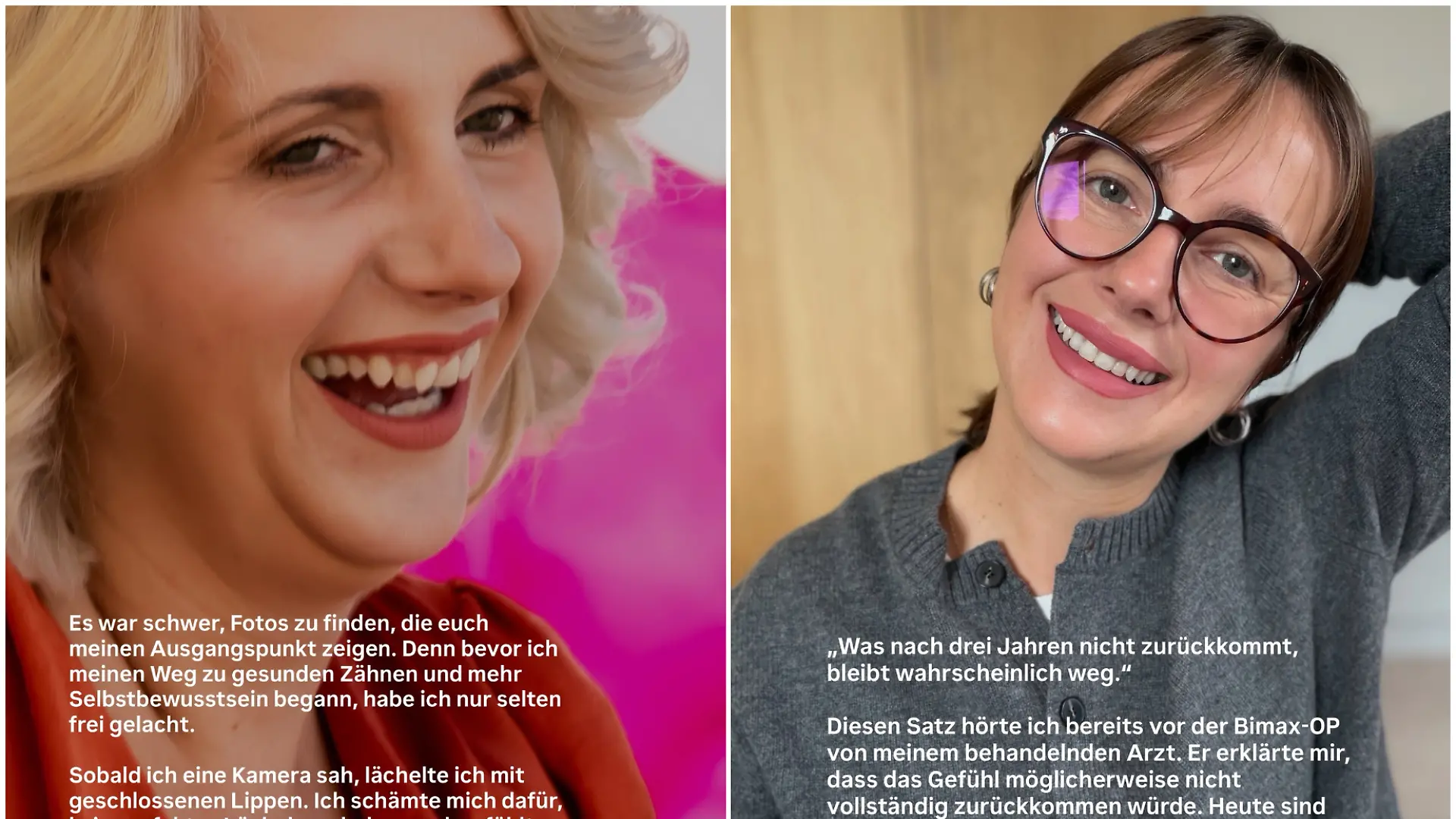 Anna Heiser lächelte früher nur selten, weil sie sich für ihre Zähne schämte. Heute sieht das anders aus. Bei Instagram zieht sie eine Vorher-Nachher-Bilanz.