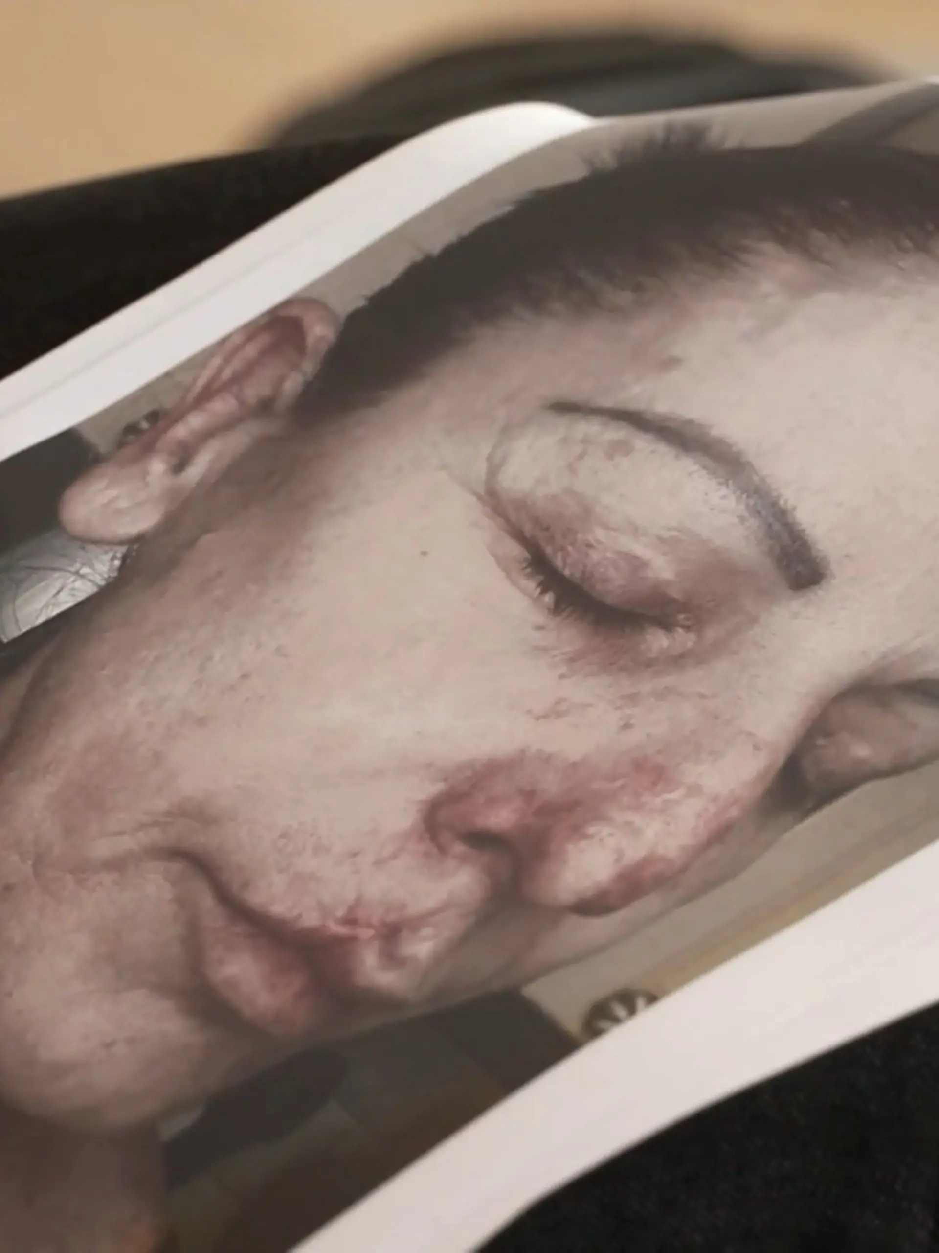 Bild zu: "Fake Beautydoc verunstaltet Dutzende Patienten"