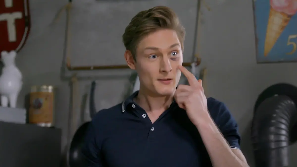 Lukes Fausthieb hat auf Conors Gesicht Spuren hinterlassen „Unter uns“-Folge vom 07.07.2021