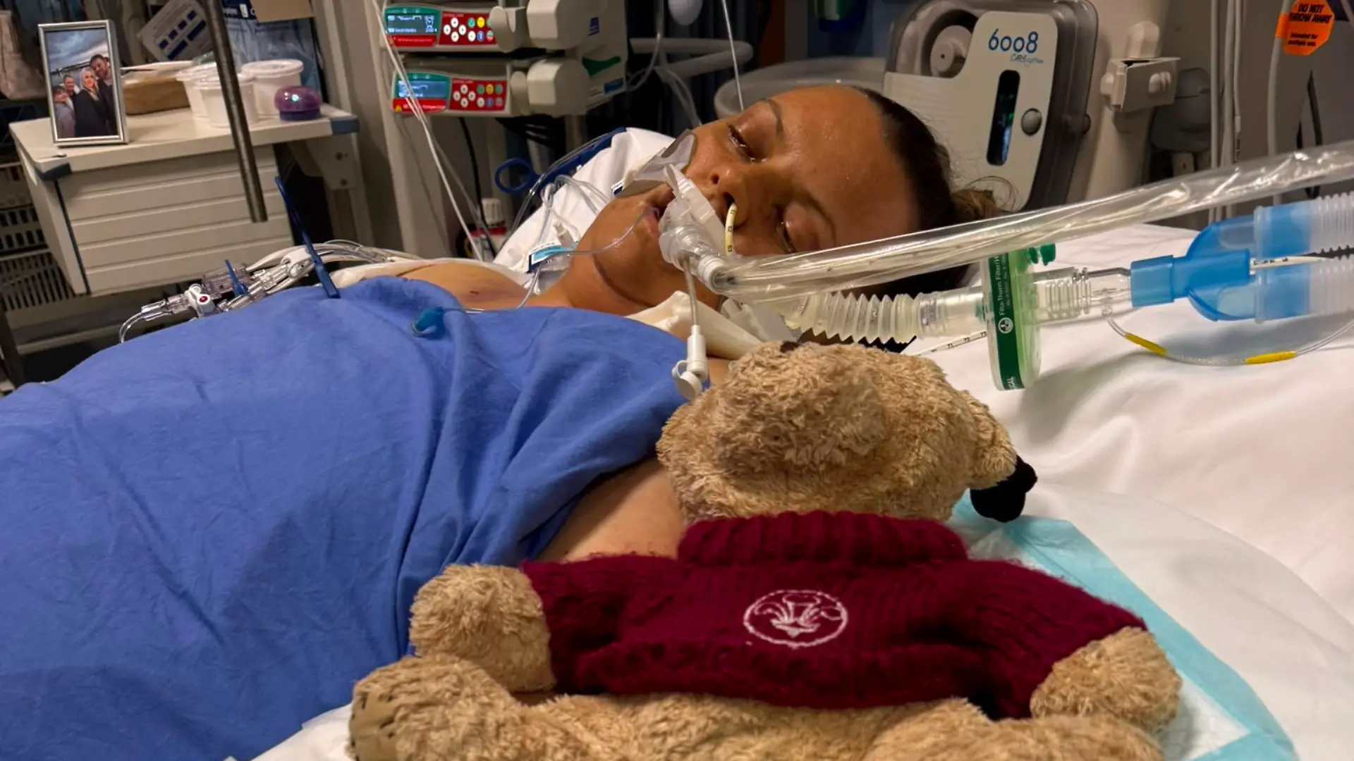 Lois Kinder in hospital. // A „fit and healthy” mum has been left brain-damaged after her liver failed when she took a popular £5 herbal supplement. Lois Kinder, 44, drank a coffee and ingested two gummies a day containing the Asian herb ashwagandha to „promote her overall wellbeing” for a year. Supplements containing ashwagandha are currently viral on social media with claims they help with relaxation and ease the symptoms of perimenopause. But last month the mum-of-two, from Lymm, in Warrington, Cheshire., noticed her eyes and skin turn yellow until and three days later was found collapsed on her settee. Photo released 17/09/2026