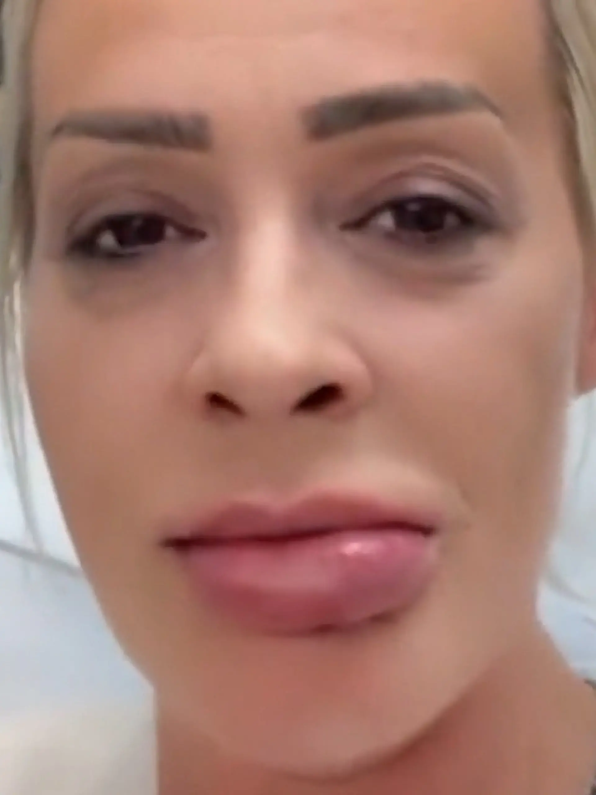 Bild zu: "Cora Schumacher total entstellt! „Kriegsverletzung“ bringt sie in die Notaufnahme"