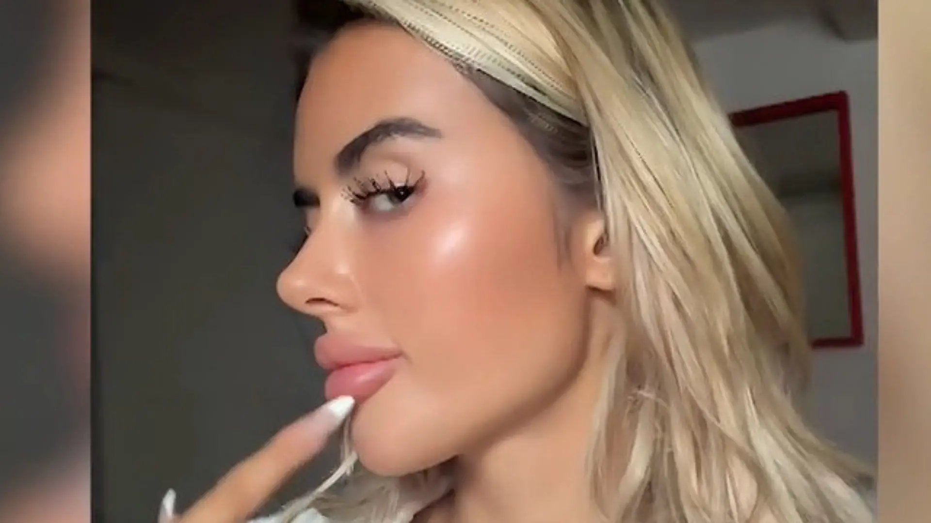 AYTO-Kandidatin Jenny beim Beauty-Doc – um DIESEN Fehler rückgängig zu machen! „Ich habe so übertrieben“