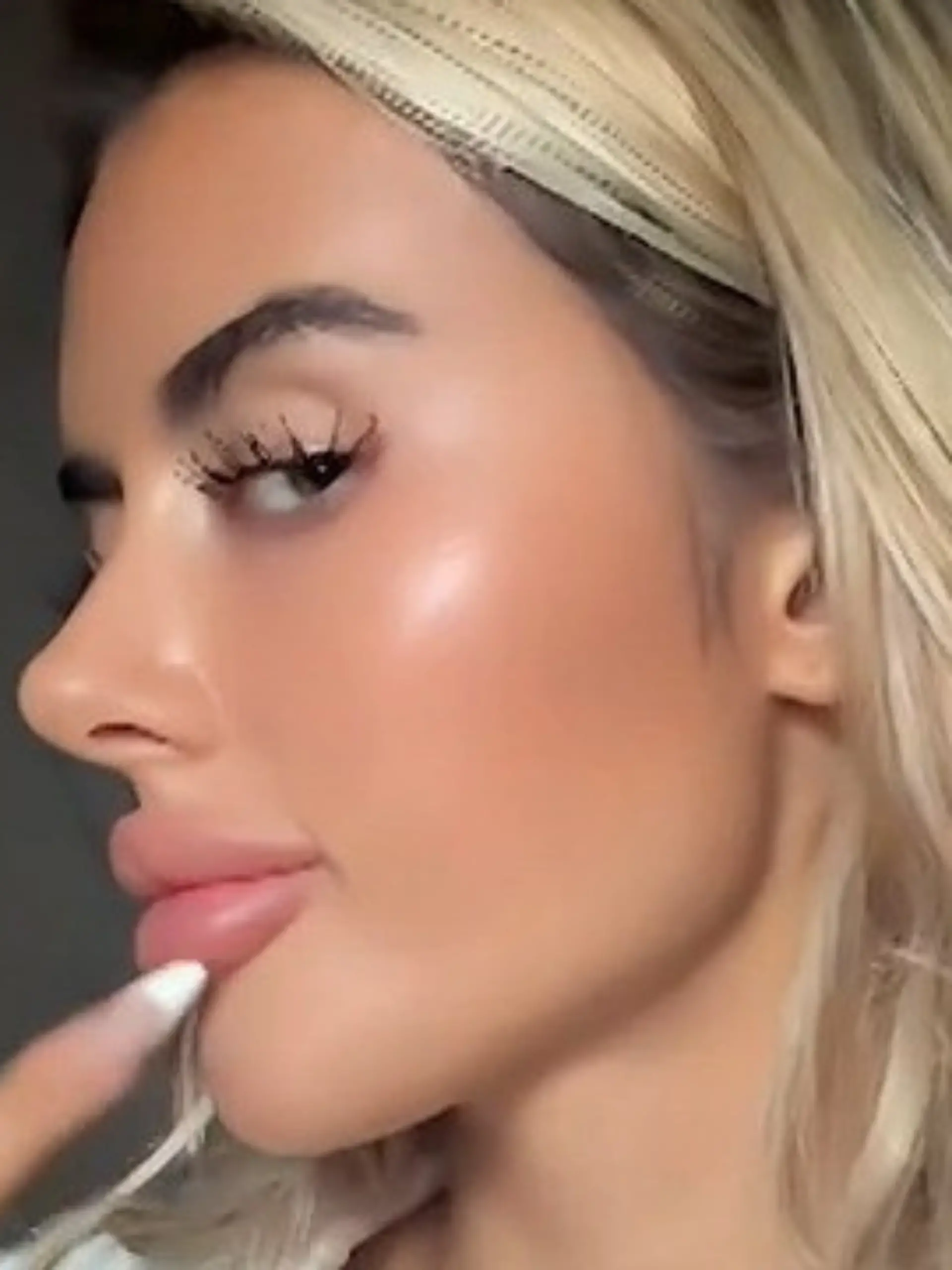 Bild zu: "AYTO-Kandidatin Jenny beim Beauty-Doc – um DIESEN Fehler rückgängig zu machen!"