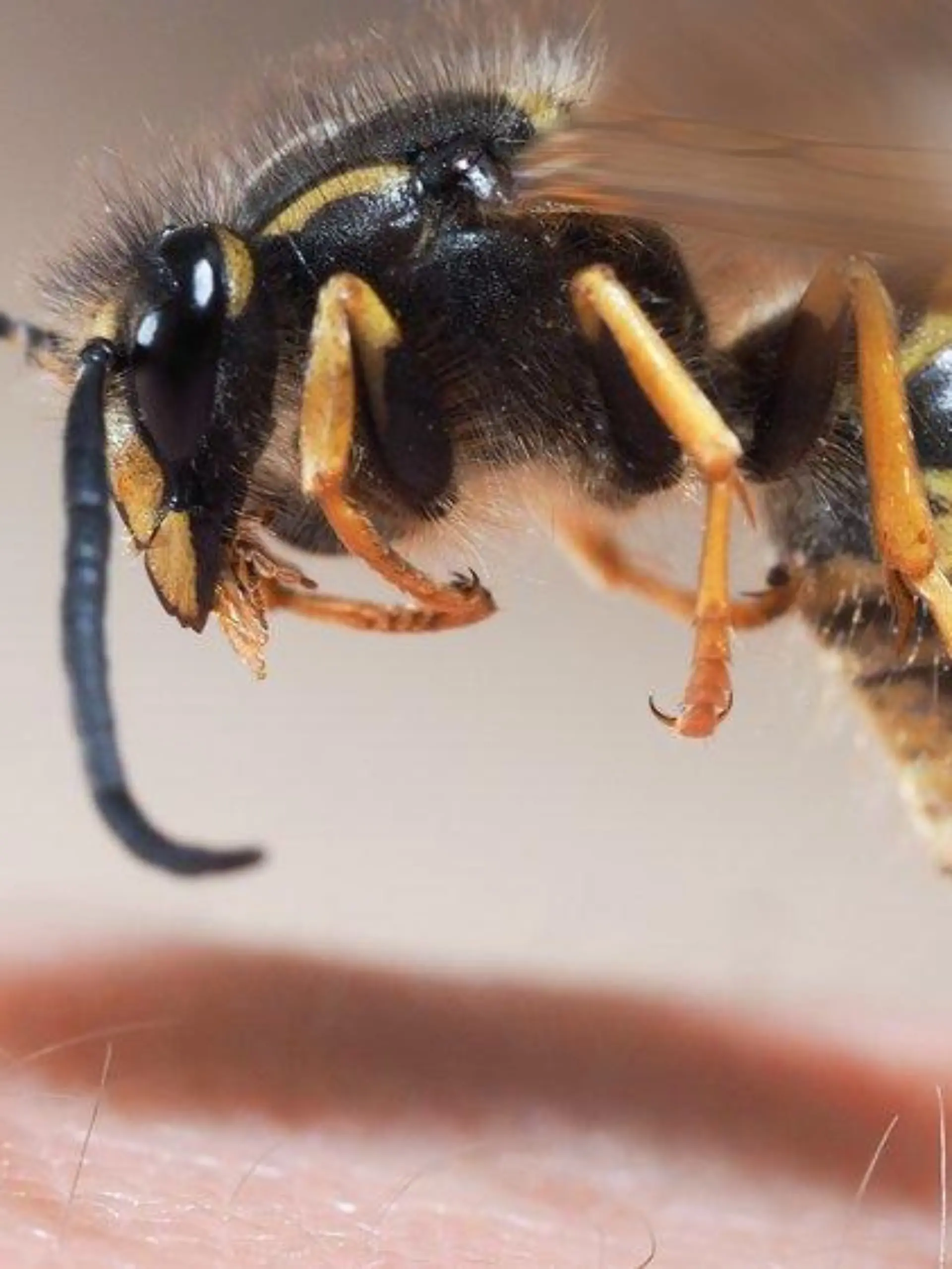 Bienen- und Wespenstiche: So reagiert man richtig