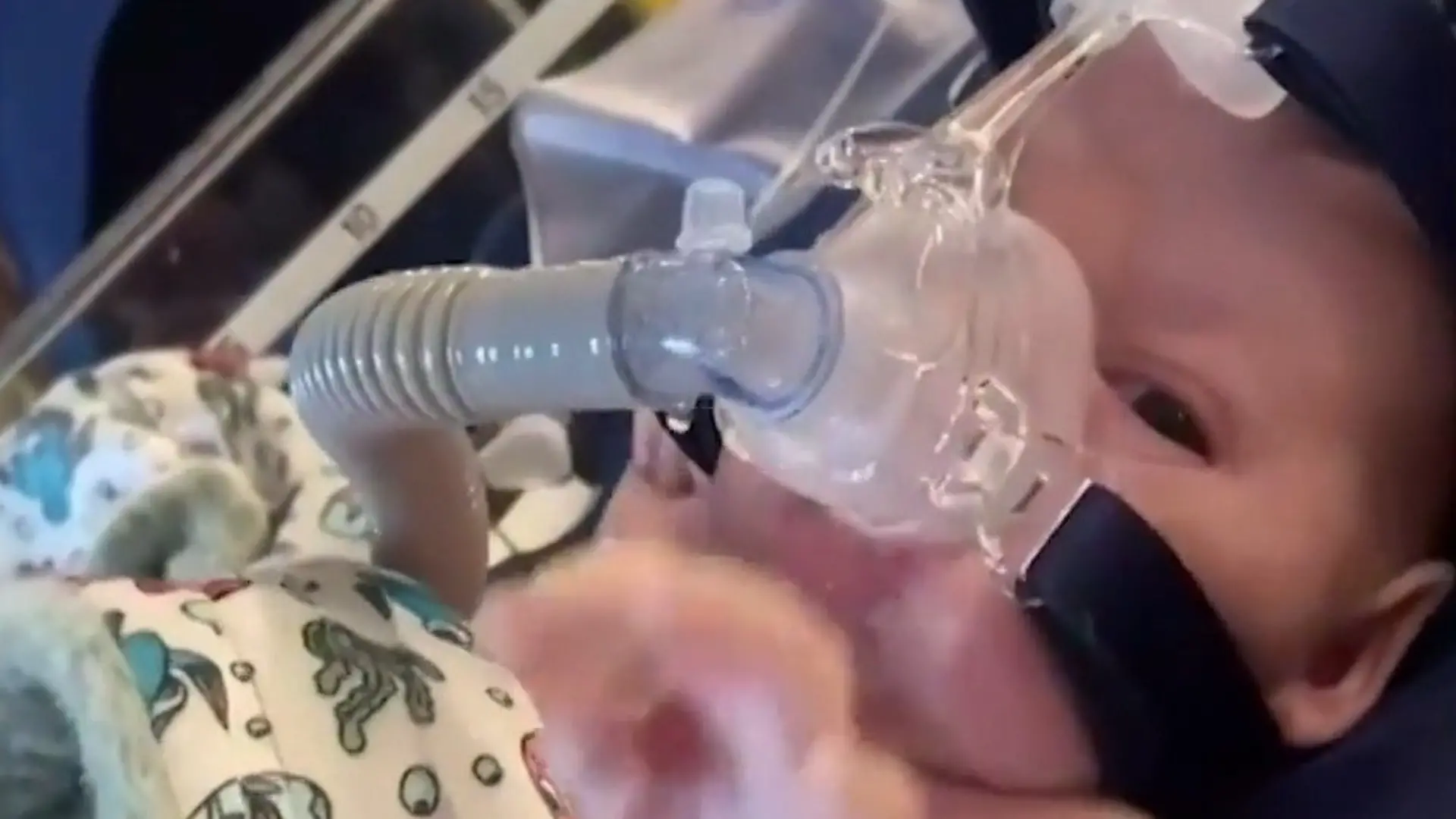 Gefährlicher Virus! Nach einem Kuss lag Baby Vinnie im Koma Säugling kämpfte um sein Leben