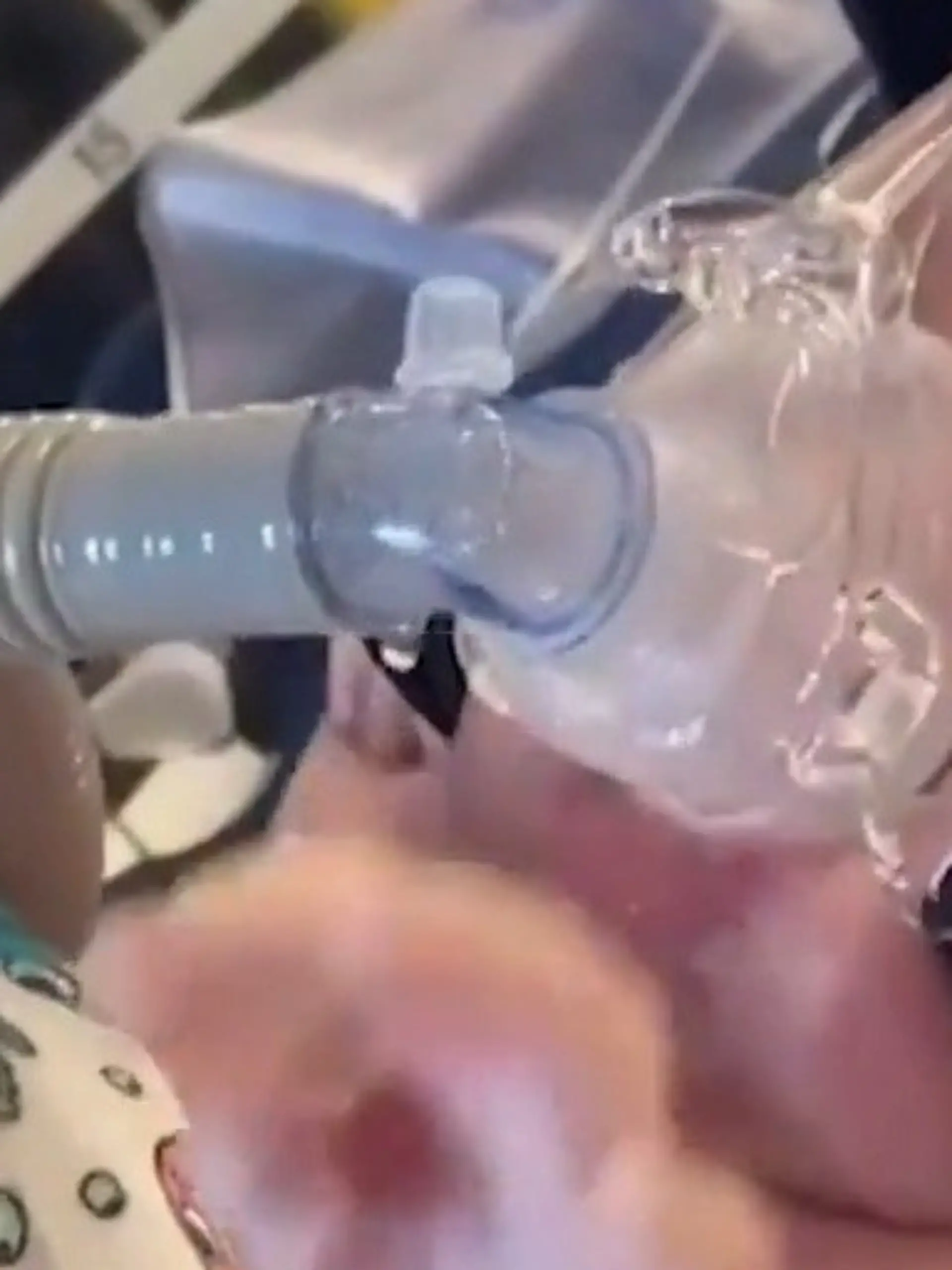 Bild zu: "Gefährlicher Virus! Nach einem Kuss lag Baby Vinnie im Koma"