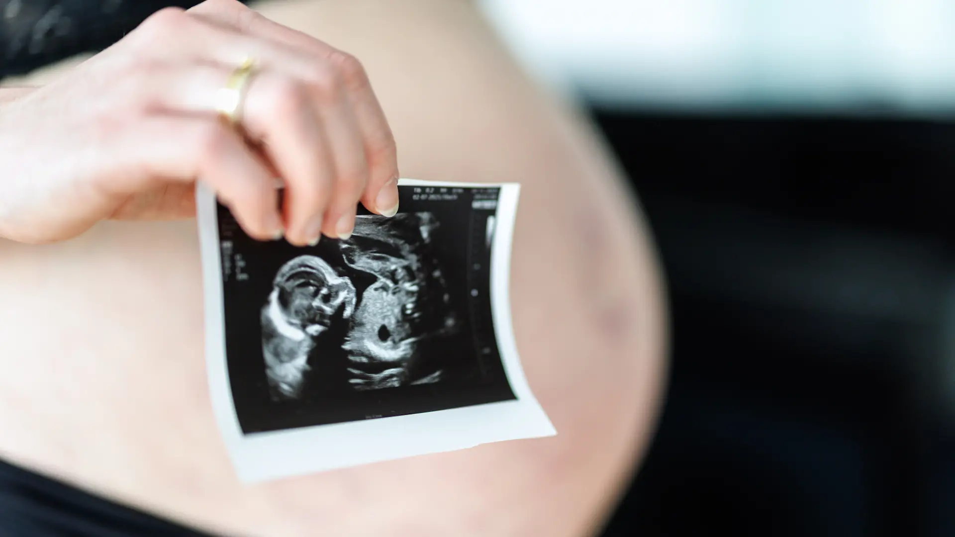 Eine schwangere Frau hält ein Ultraschallfoto von ihrem Baby in den Händen, während im Hintergrund ihr Babybauch zu sehen ist.