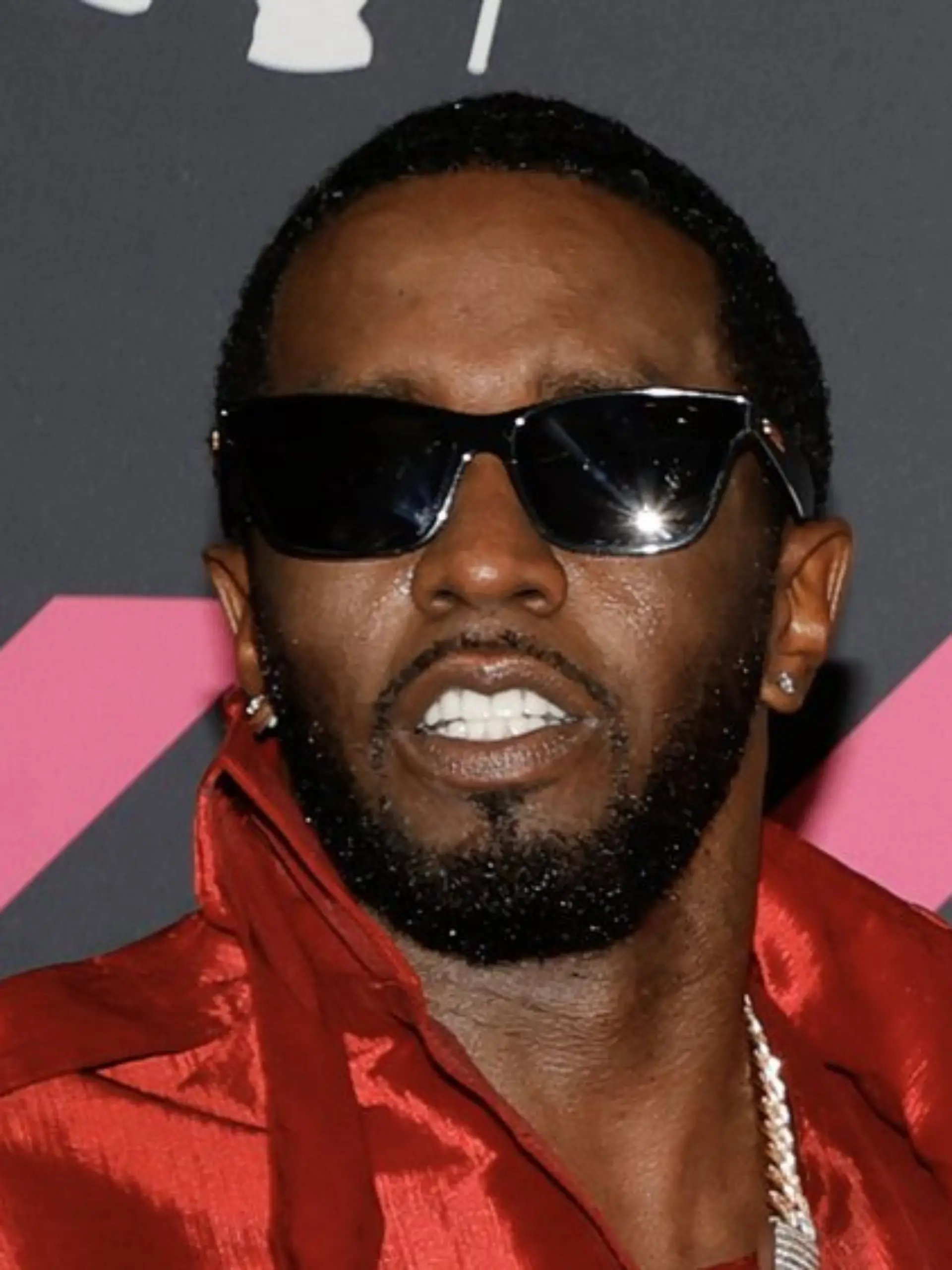 Diddy soll sich am Kopf verletzt haben.