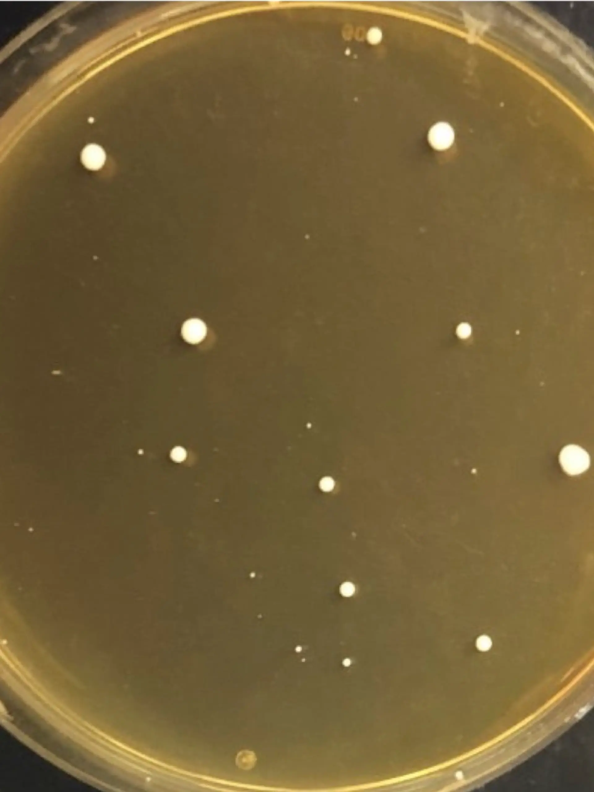 HANDOUT - VERWENDUNG NUR IN ZUSAMMENHANG MIT DER STUDIE
Caption: Image of the plate showing different rates of cell growth
Credit: University of Exeter
Usage Restrictions: Only to be used in connection with coverage of University of Exeter press release on Candida auris, released October 2026
License: Original content
Quelle: https://www.eurekalert.org/multimedia/1157048 Foto: University of Exeter
