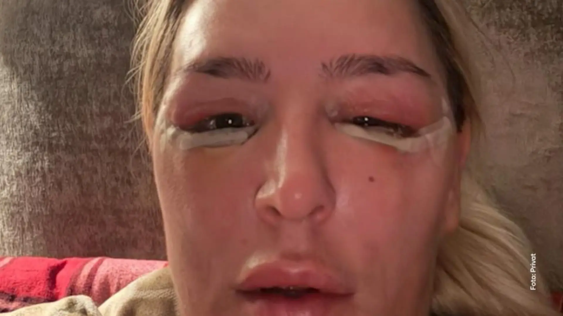 Beauty-Kette Aesthetify: Arzt ohne Zulassung wegen behandlungsfehlern vor Gericht Prozess gegen falschen Beauty-Arzt