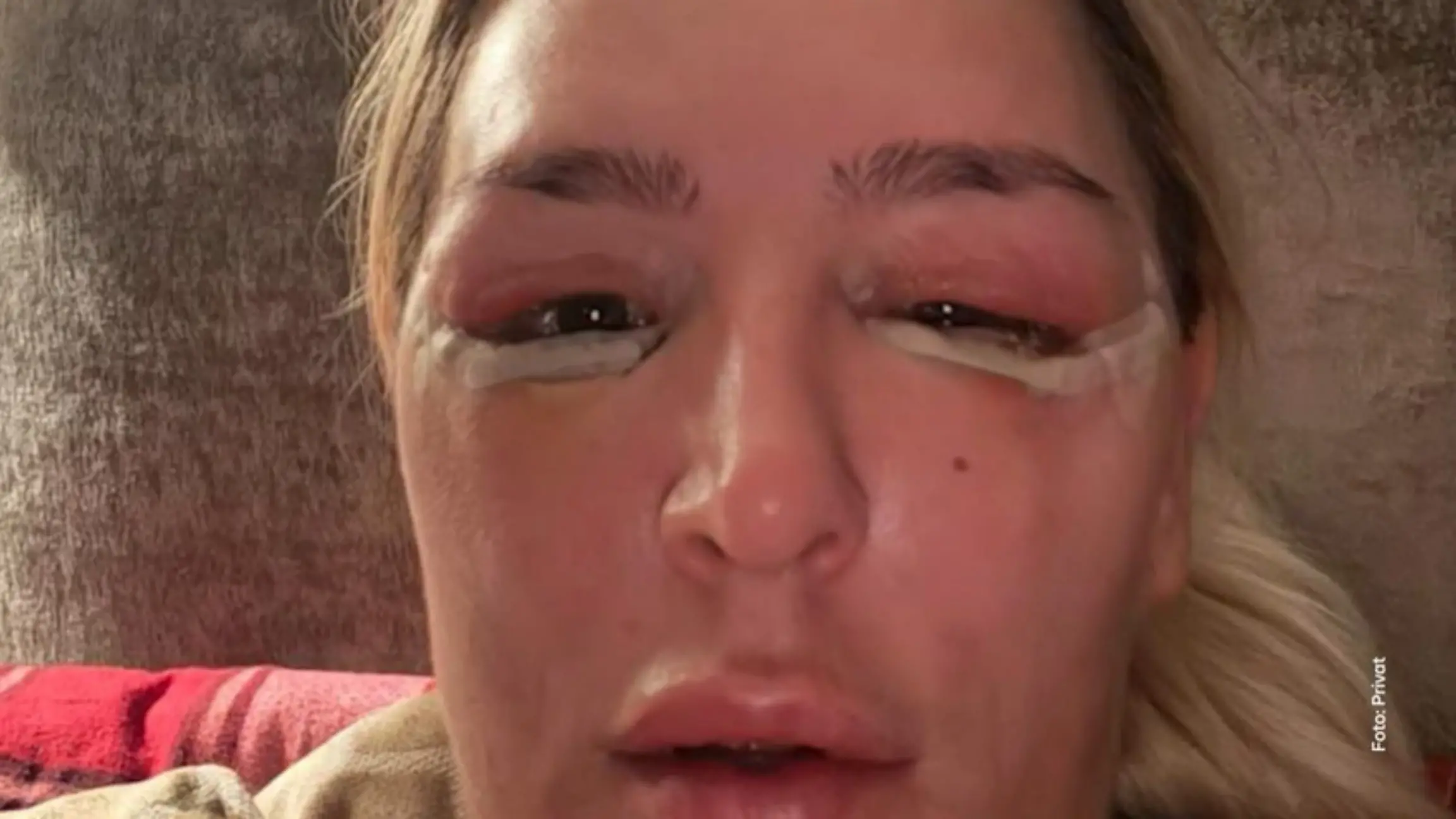 Beauty-Kette Aesthetify: Arzt ohne Zulassung wegen behandlungsfehlern vor Gericht Prozess gegen falschen Beauty-Arzt