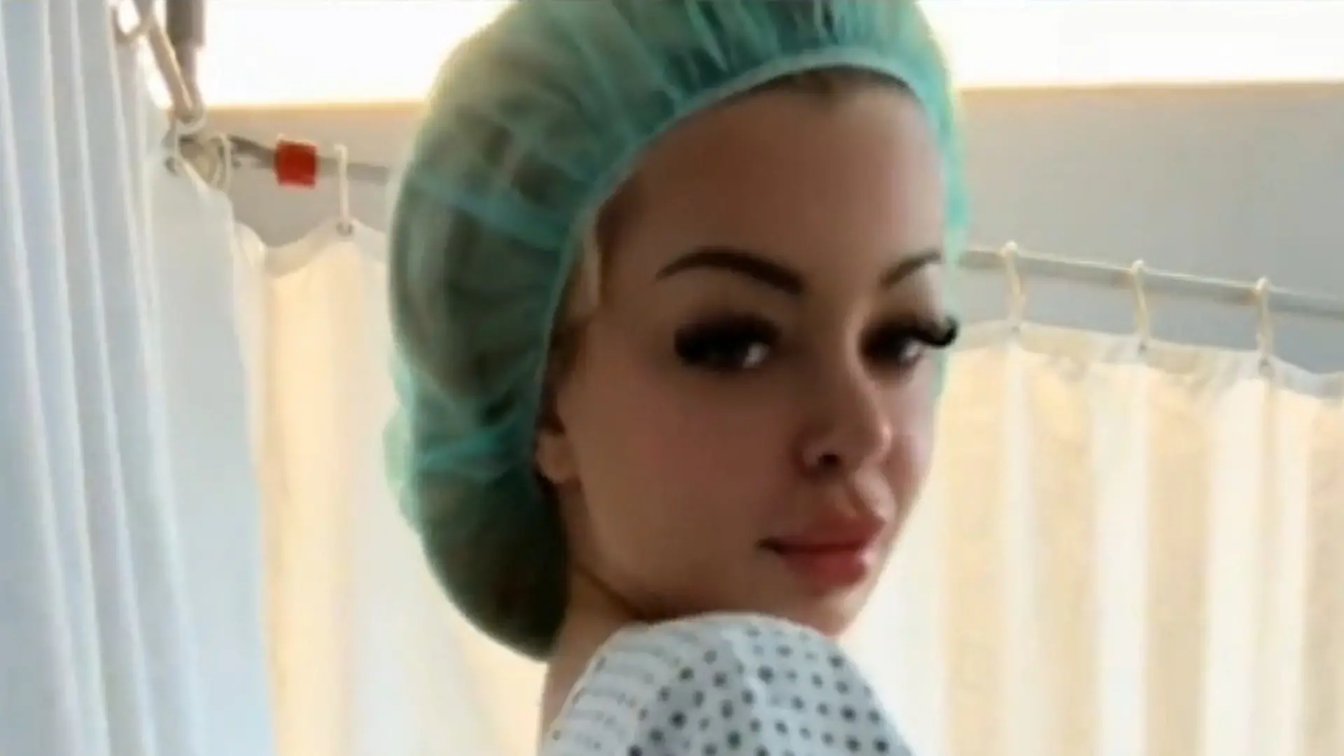 Krasse Beauty-OP bei Katja Krasavice! DIESES Körperteil opfert Rapperin für neue Nase „Ich habe einen Riesenschaden“