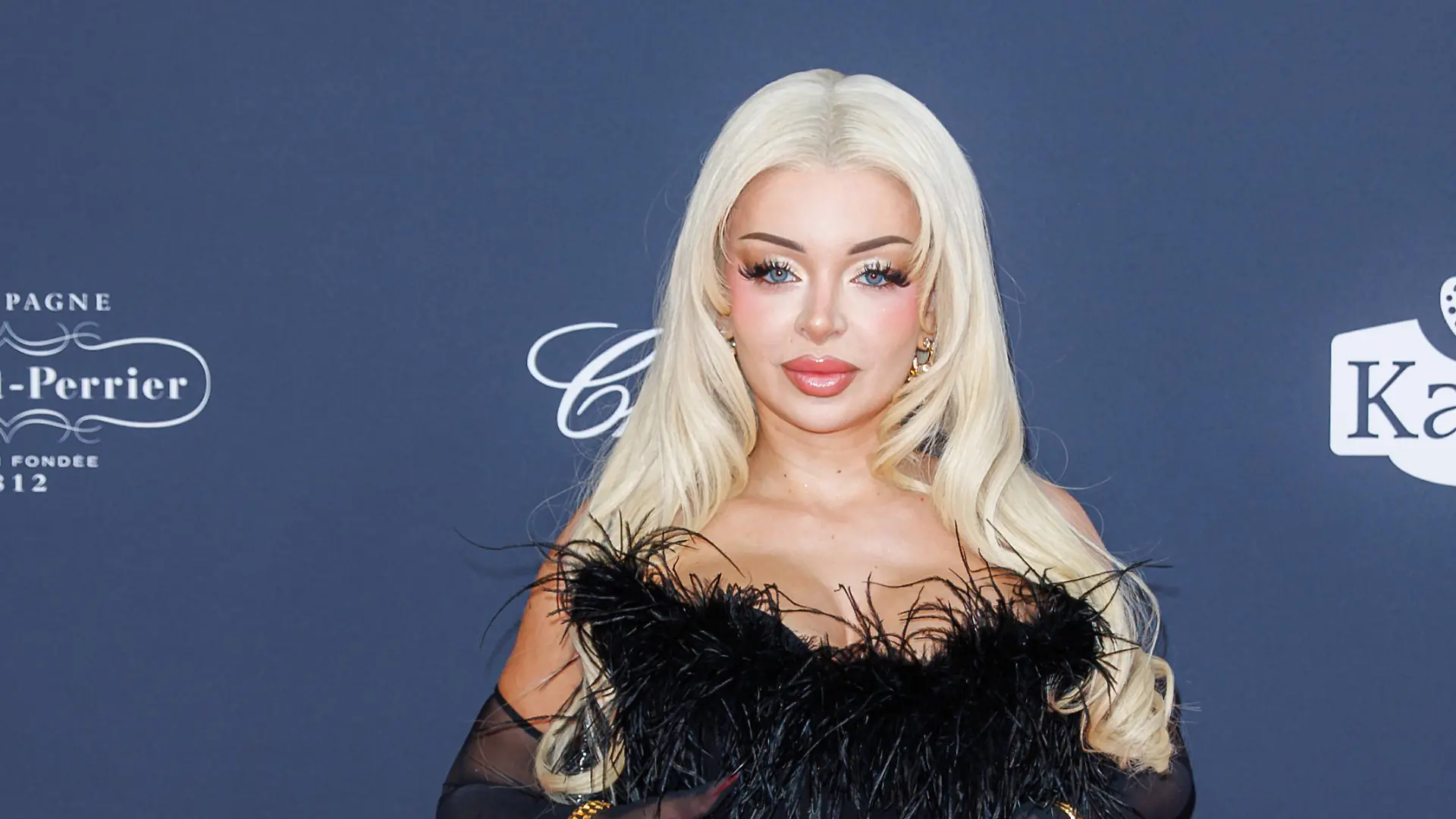 Krasse Beauty-OP bei Katja Krasavice! DIESES Körperteil opfert Rapperin für neue Nase „Ich habe einen Riesenschaden“