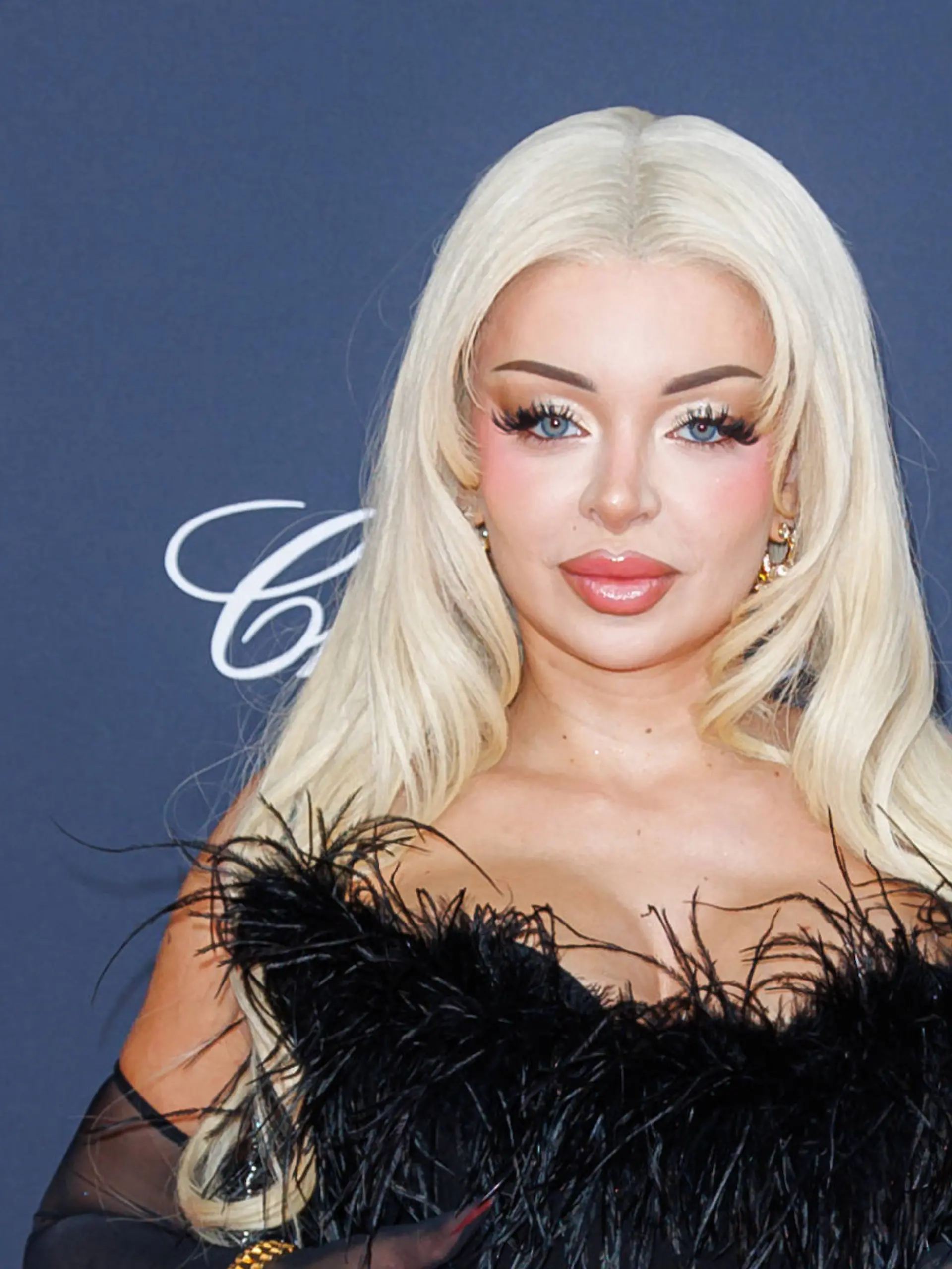 Bild zu: "Krasse Beauty-OP bei Katja Krasavice! DIESES Körperteil opfert Rapperin für neue Nase"
