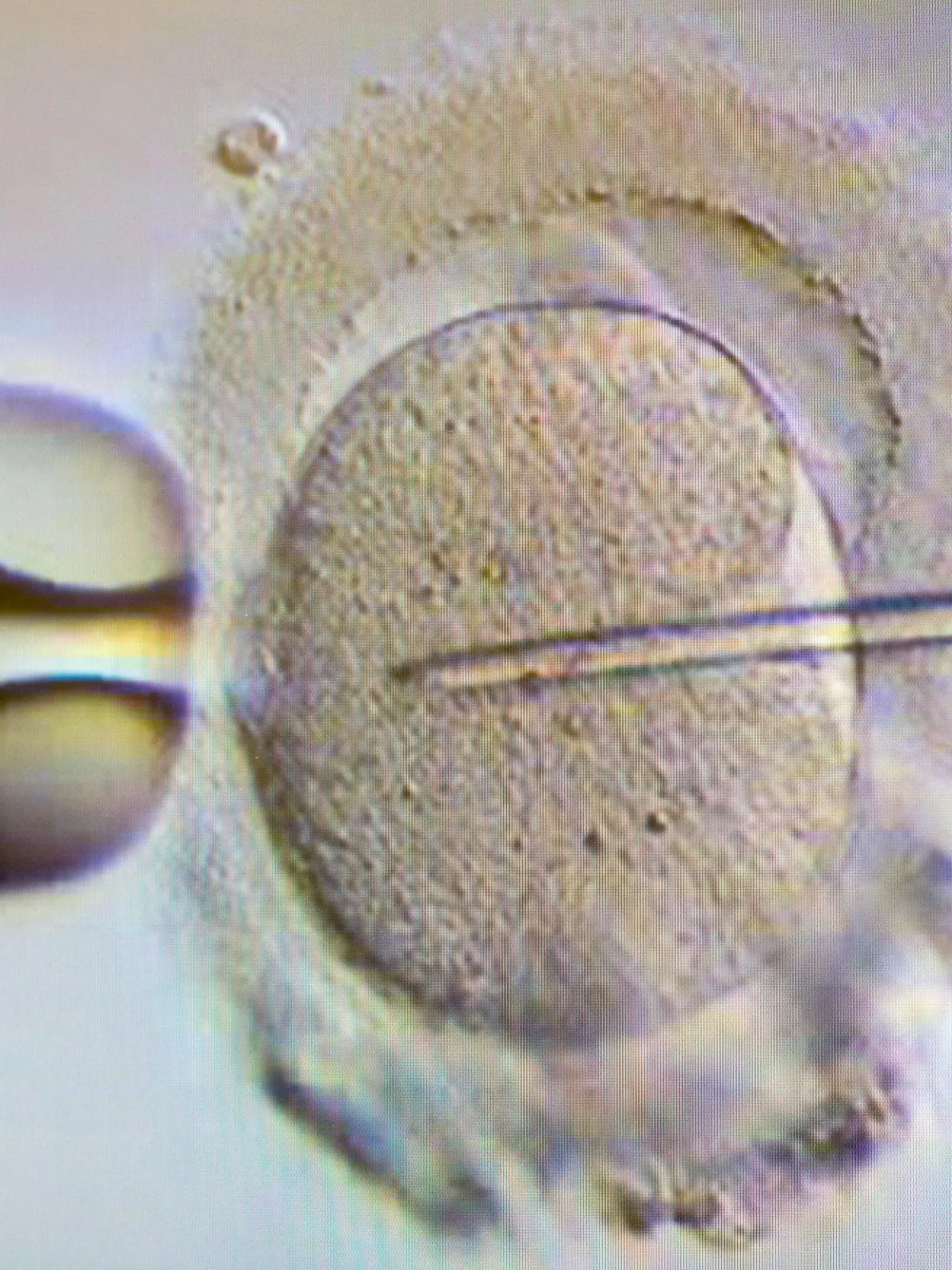 Künstliche Befruchtung