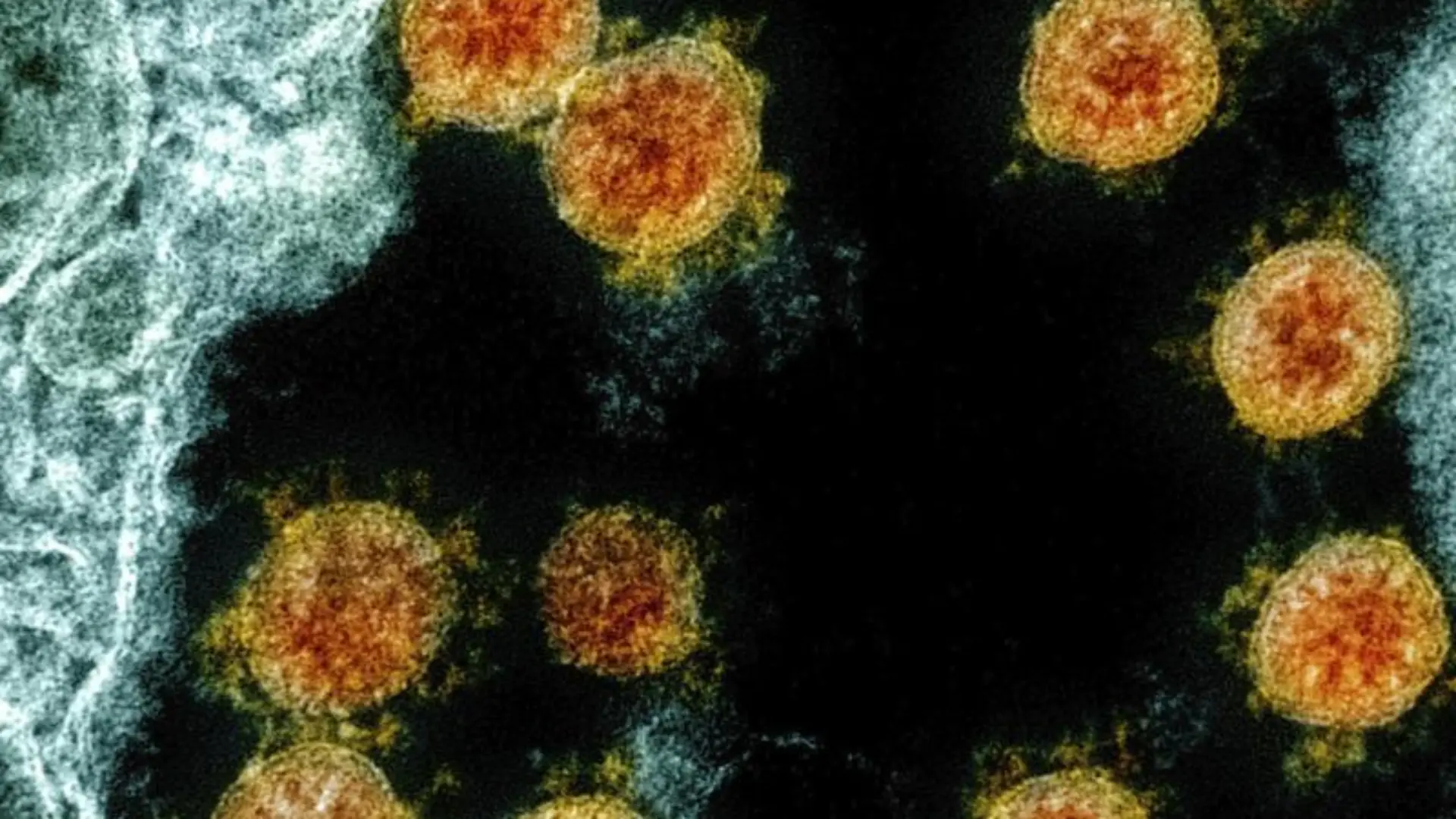 Coronavirus