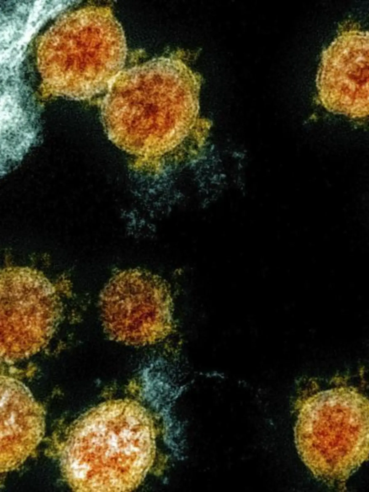 Coronavirus