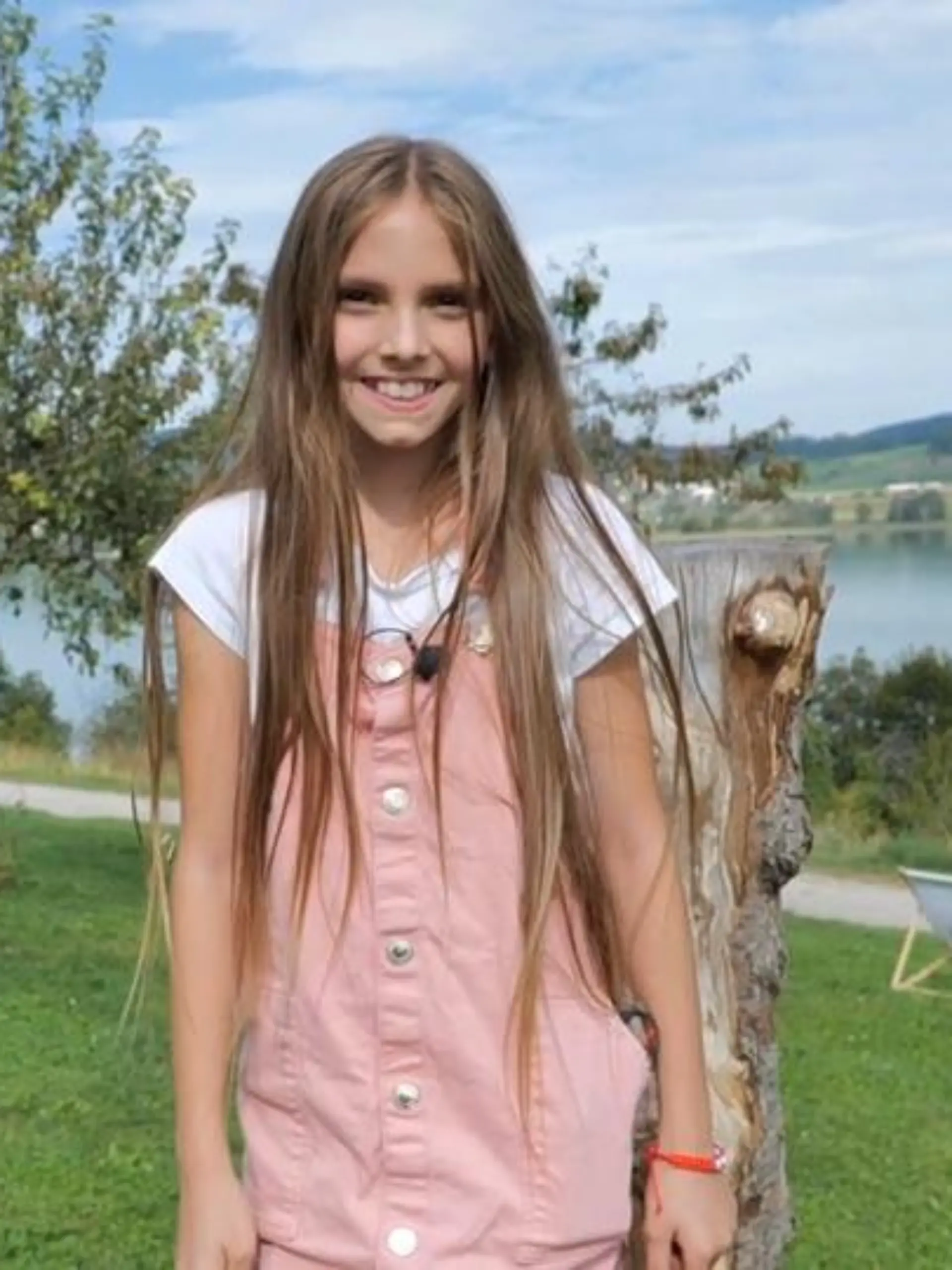 Mit ihren neun Jahren hat Alisa Veseli aus Weisslingen in der Schweiz bereits 75 Operationen hinter sich. Sie verschluckte im Alter von 20 Monaten eine Knopfbatterie, als ihre Mutter einen Moment unaufmerksam war. Der Stromfluss der Batterie zerstörte das Gewebe ihrer Speiseröhre. Die Folgen spürt Alisa bis heute - doch sie bleibt lebensfroh.