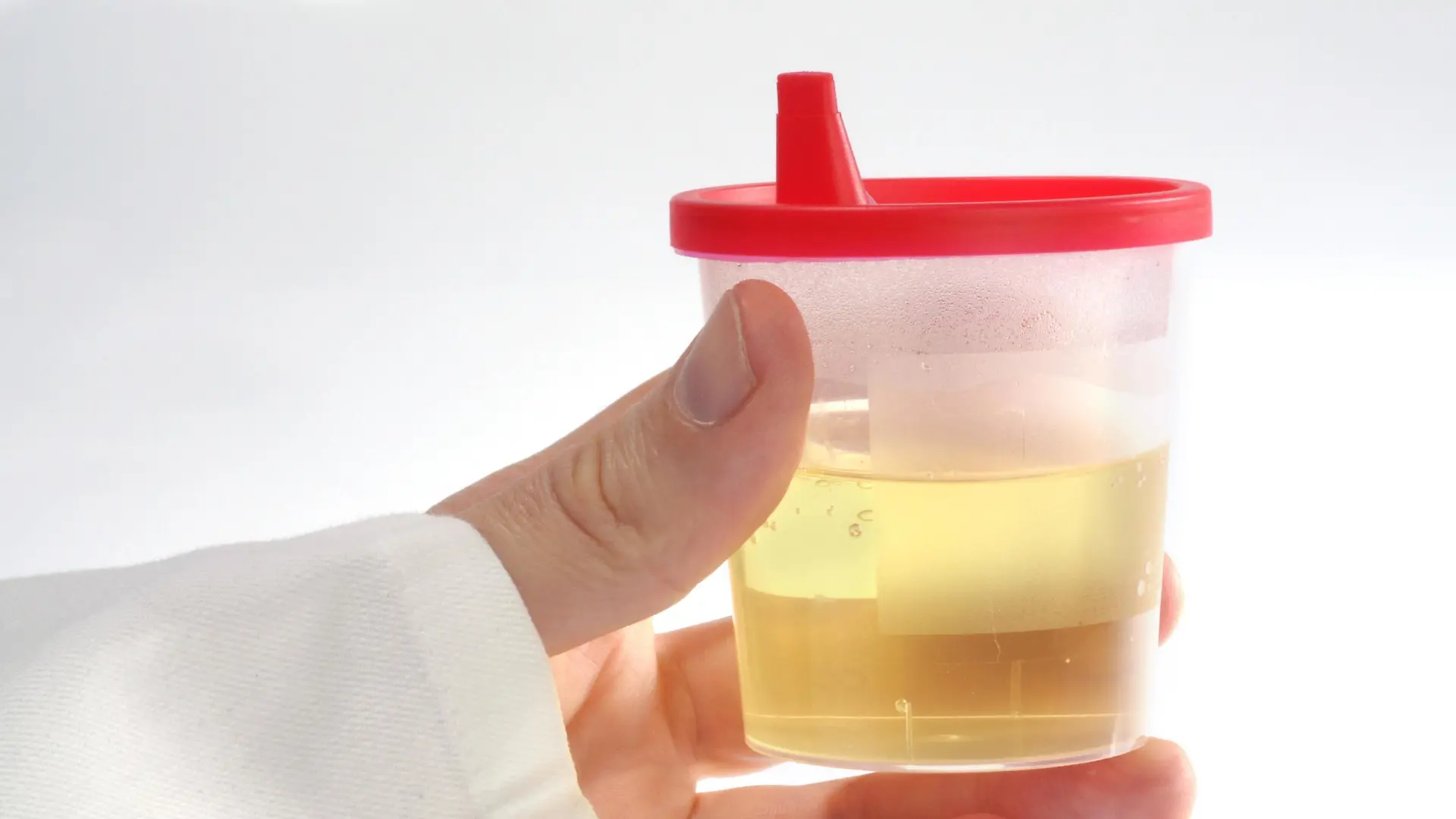 Eine Hand hält einen gefüllten Becher für Urintest | Verwendung weltweit, Keine Weitergabe an Wiederverkäufer.