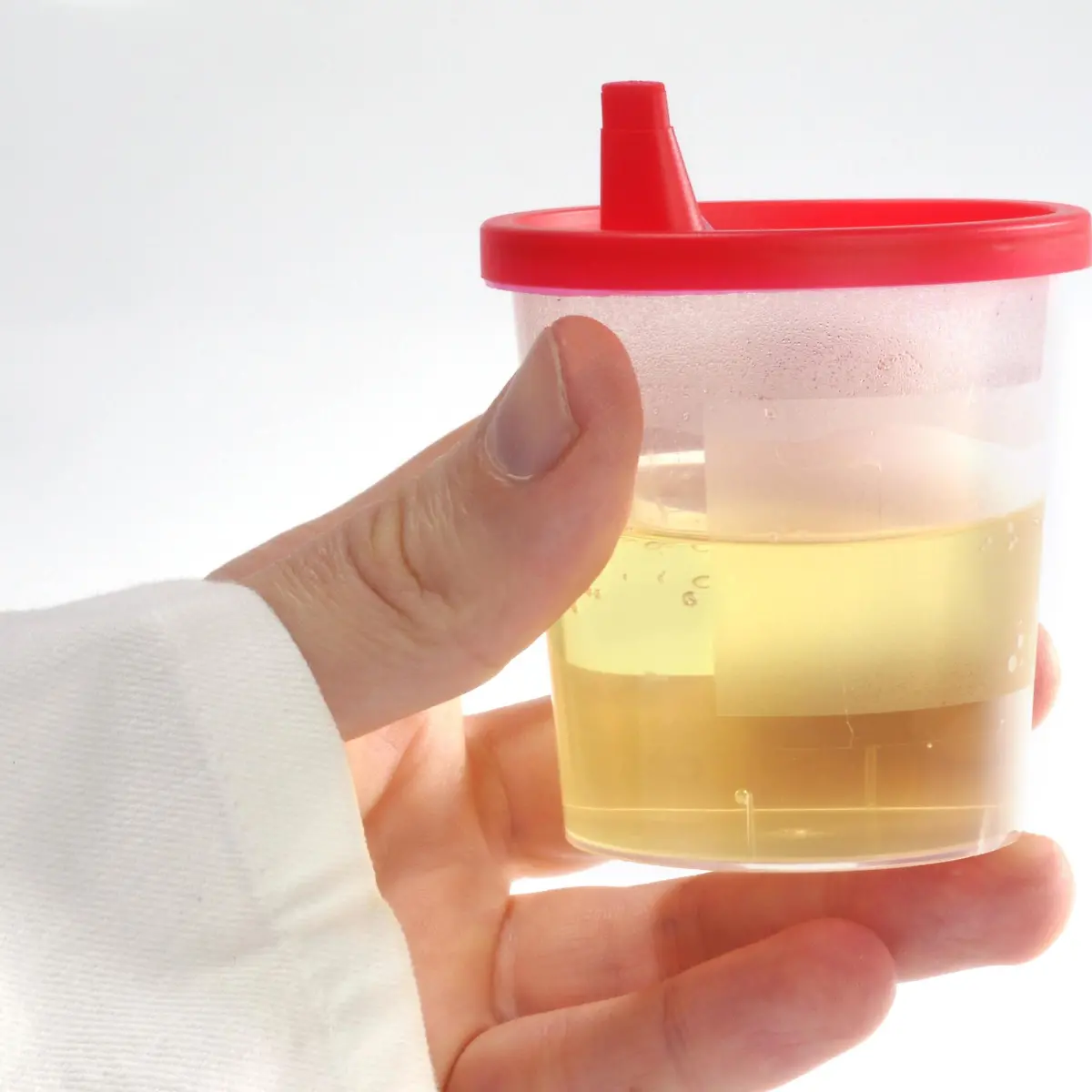 nephrotisches Syndrom Logo von nephrotisches Syndrom