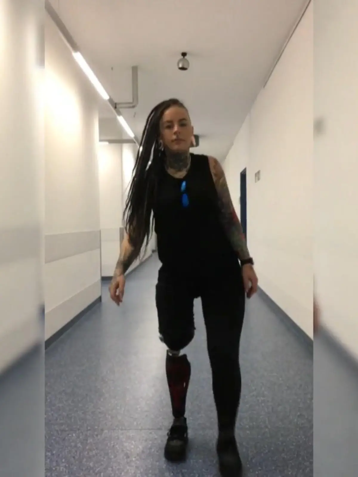 Bild zu: "Freiwillige Amputation mit 25 Jahren"