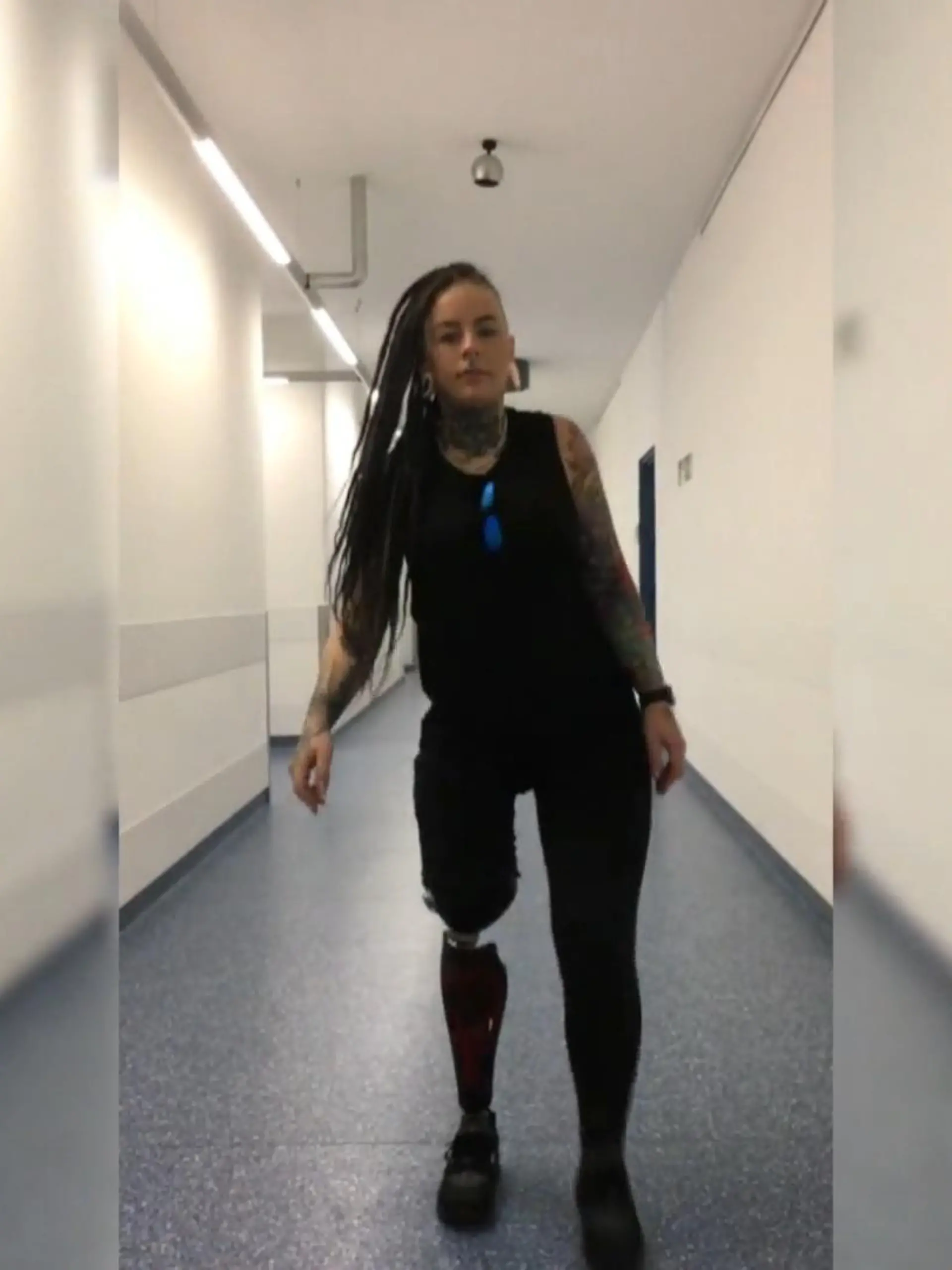 Bild zu: "Freiwillige Amputation mit 25 Jahren"